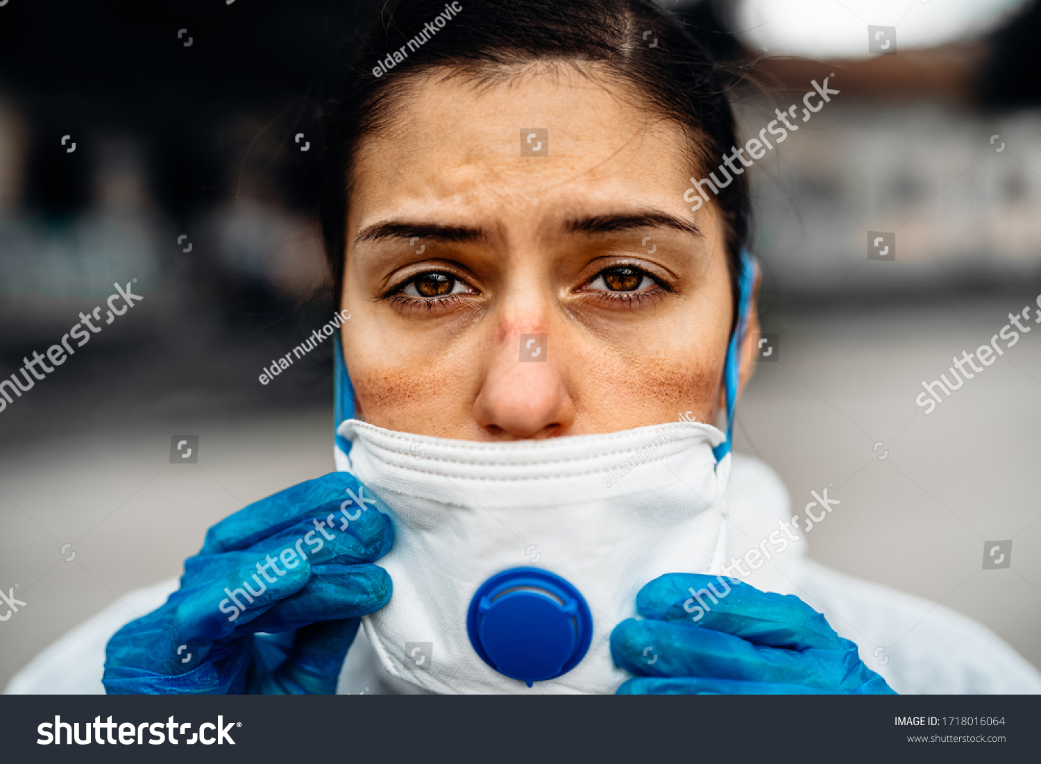 Exhausted doctor/nurse wearing coronavirus protective gear N95 mask uniform.Coronavirus Covid-19 outbreak.Mental stress of frontline worker.Face scars.Mask shortage.Overworked healthcare professional #1718016064
