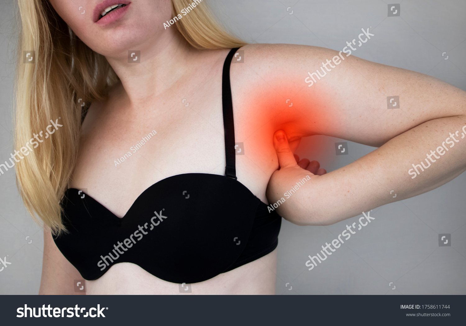 A woman suffers from pain in the armpit. Sweating, unpleasant odor, redness, tooth and inflammation in the armpit. Breast Cancer Prevention Concept #1758611744
