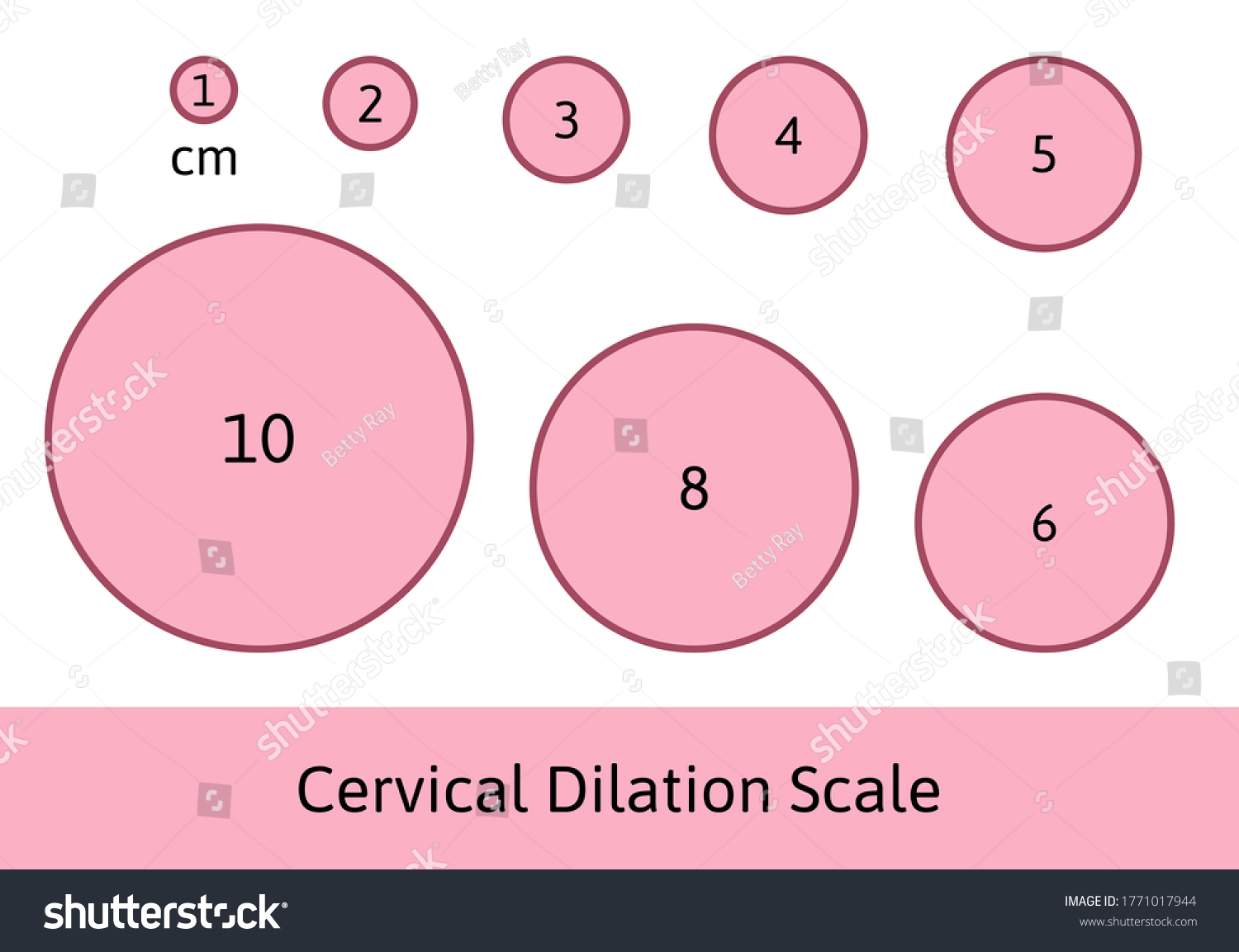 Cervial Dilation Scale with pink circles. Shows how cervix is opening during delivery process. Medical Illustration chart in centimeters. Isolated on white background. #1771017944
