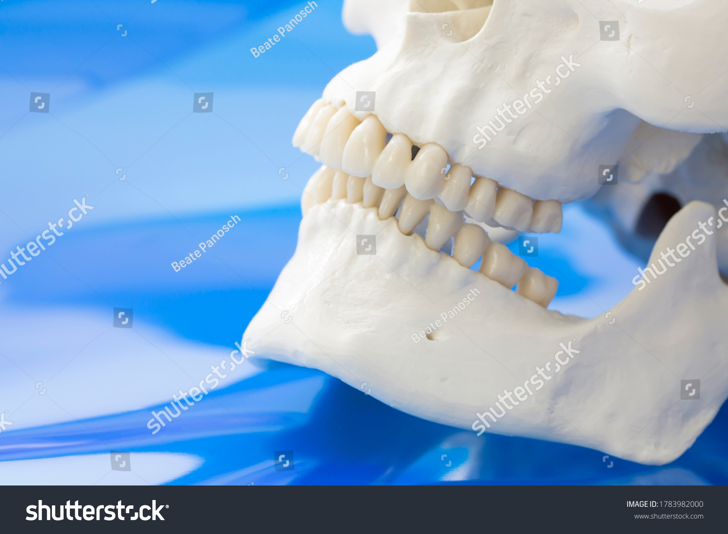 Model of retrognathism. Jawbones with maxillary and mandibular dentition and lower jaw set further back than upper jaw on blue background #1783982000