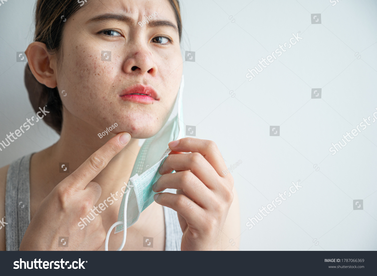 Asian woman worry about acne occur on her face after wearing mask for long time during covid-19 pandemic. Wearing mask for prolonged periods can damage the skin. #1787066369
