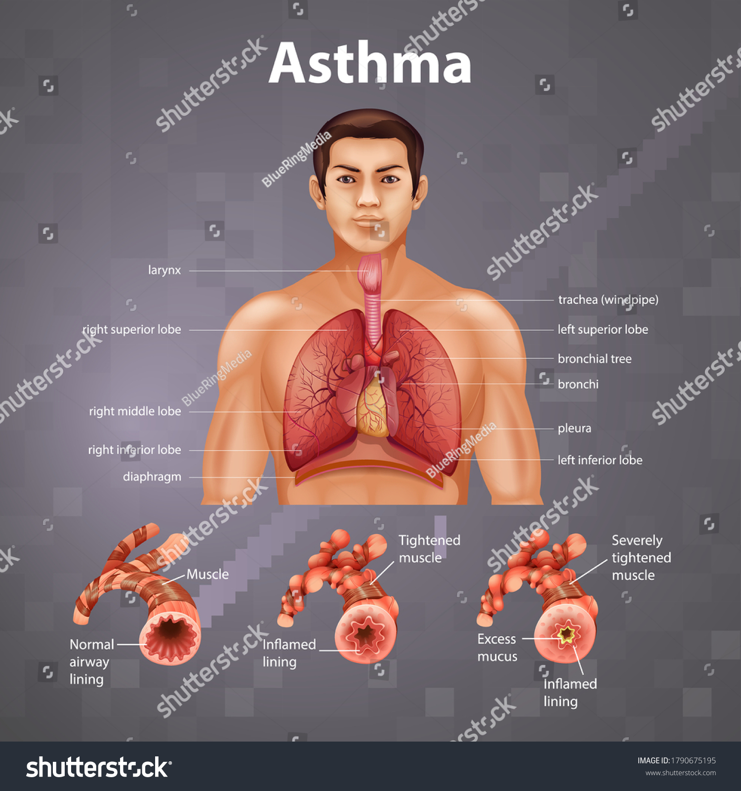 Human anatomy Asthma diagram illustration #1790675195