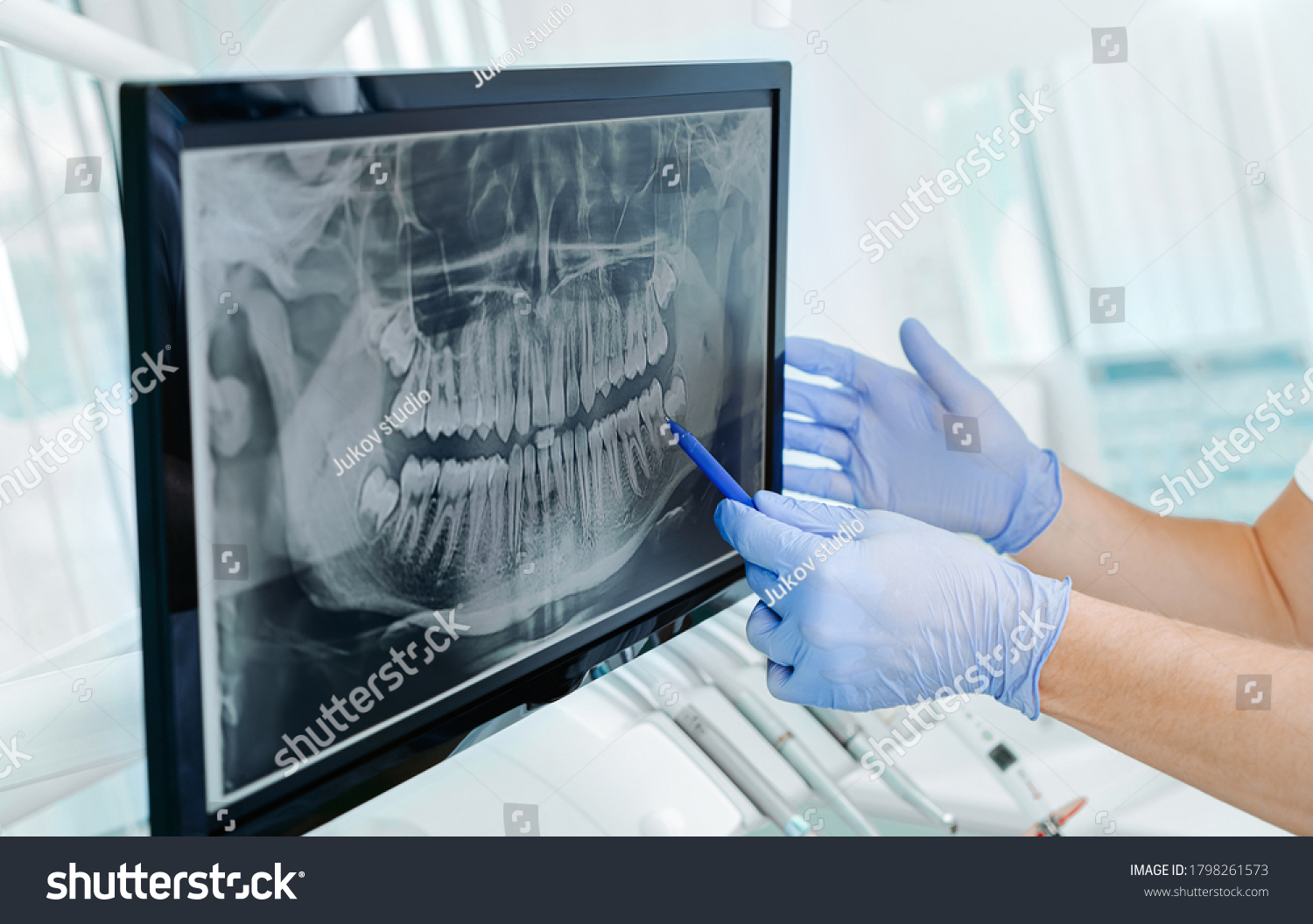 Hands doctor dentist in gloves show the teeth on x-ray on digital screen in dental clinic on light background with medical equipment. Smile healthy teeth concept, close up #1798261573