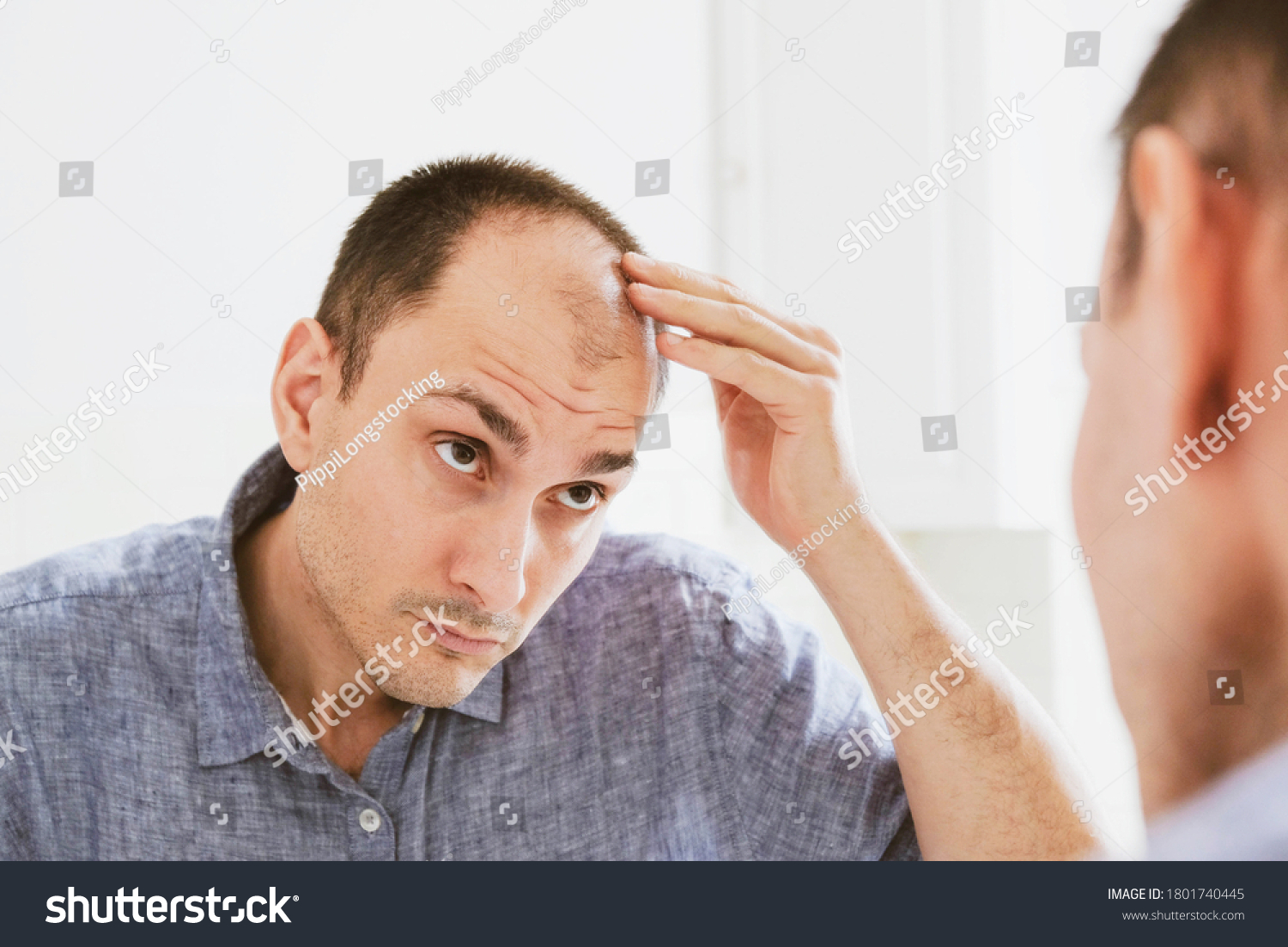 Male pattern hair loss problem concept. Young caucasian man looking at mirror worried about balding. Baldness, alopecia in males. #1801740445