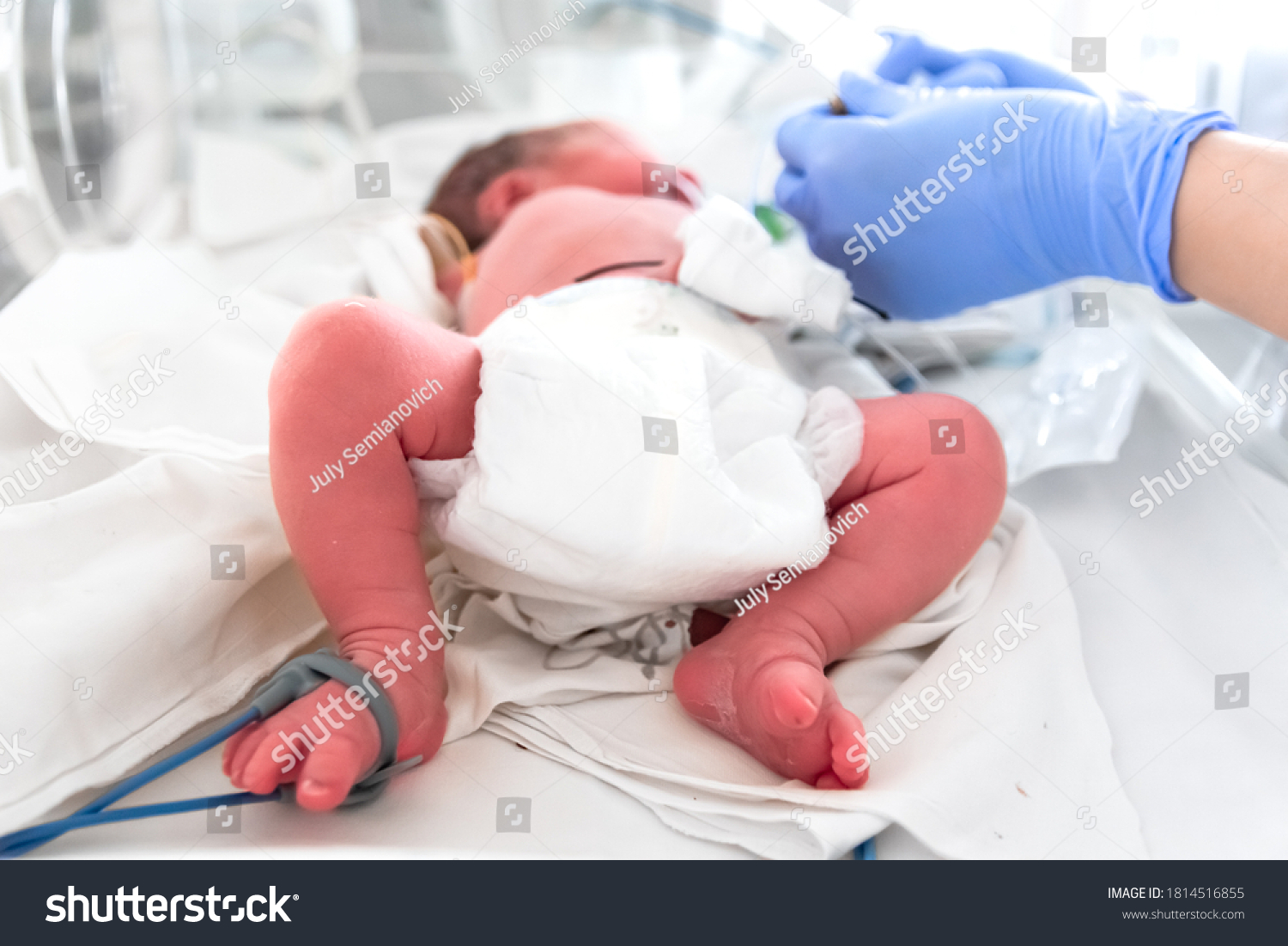 Nurse in blue gloves takes action to monitor and care for premature baby, selective focus on baby feet. Newborn is placed in the incubator. Neonatal intensive care unit #1814516855