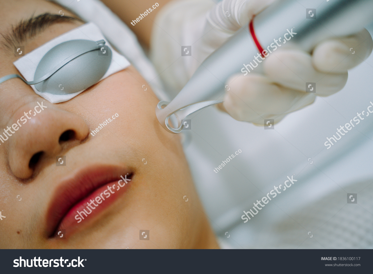 Asian woman getting laser and ultrasound face treatment in medical spa center. #1836100117