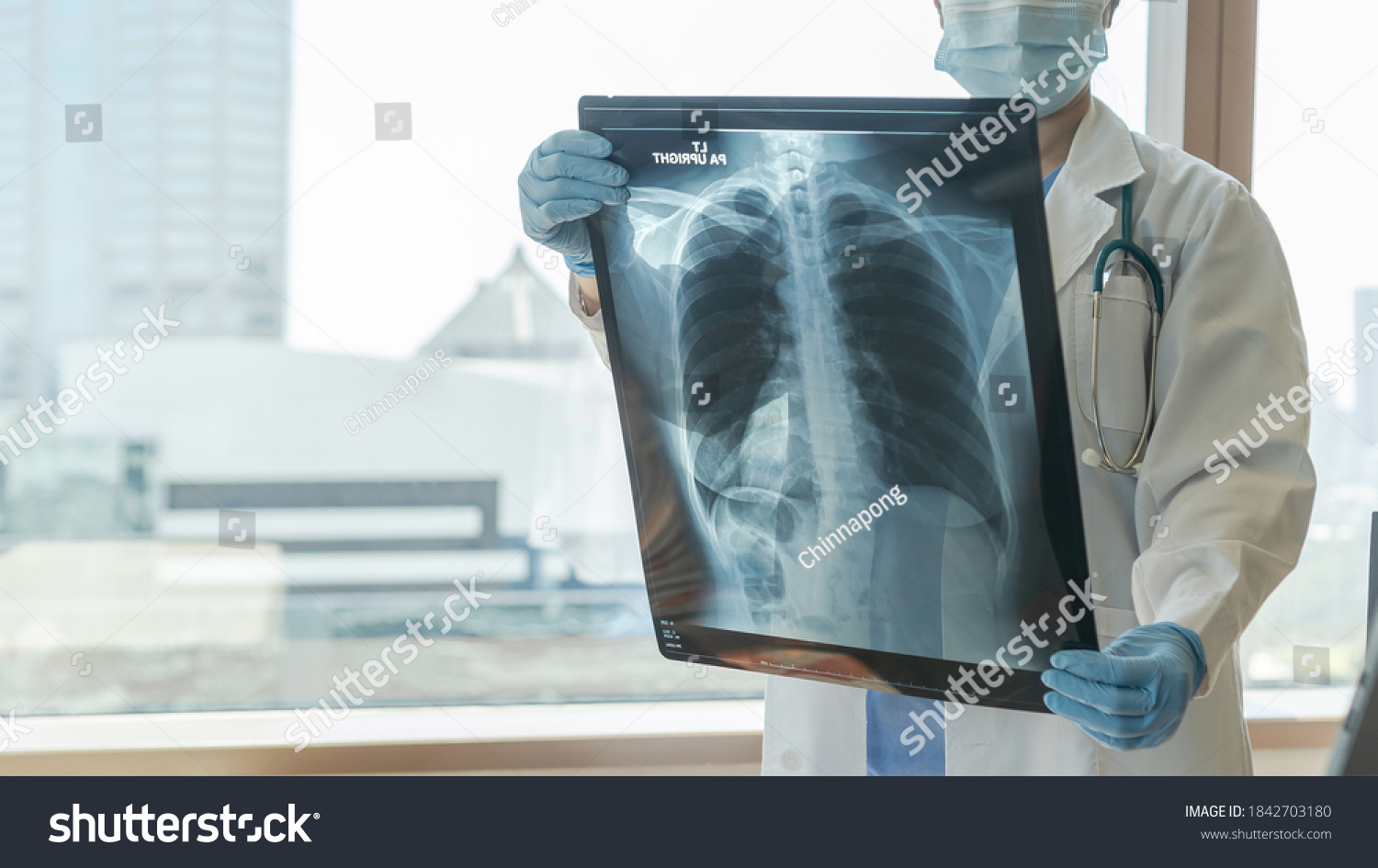 Doctor diagnosing patient’s health on asthma, lung disease, COVID-19 or bone cancer illness with radiological chest x-ray film for medical healthcare hospital service #1842703180