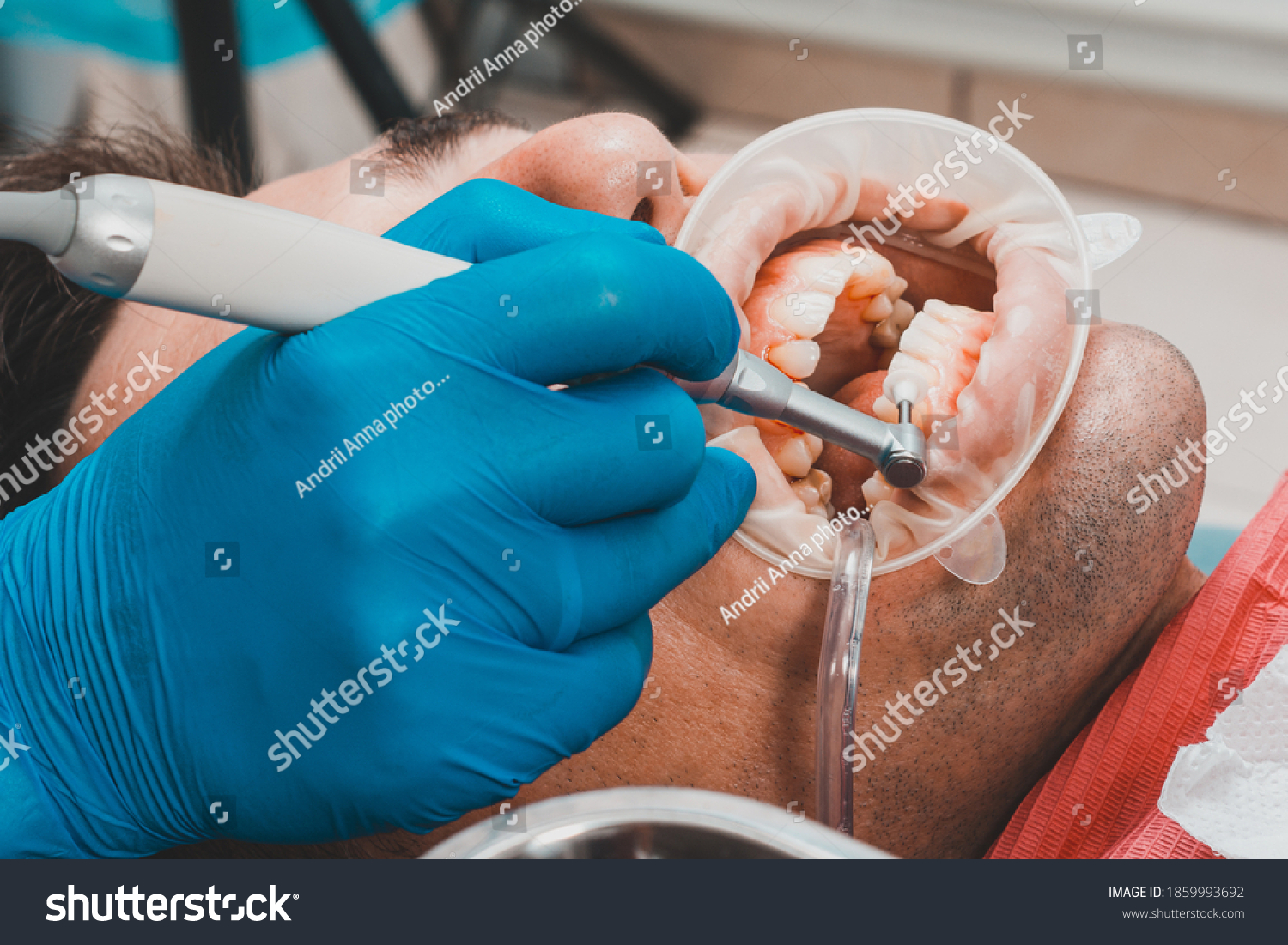 patient removing tartar,the dentist uses ultrasound to remove tartar,dental scaler. #1859993692