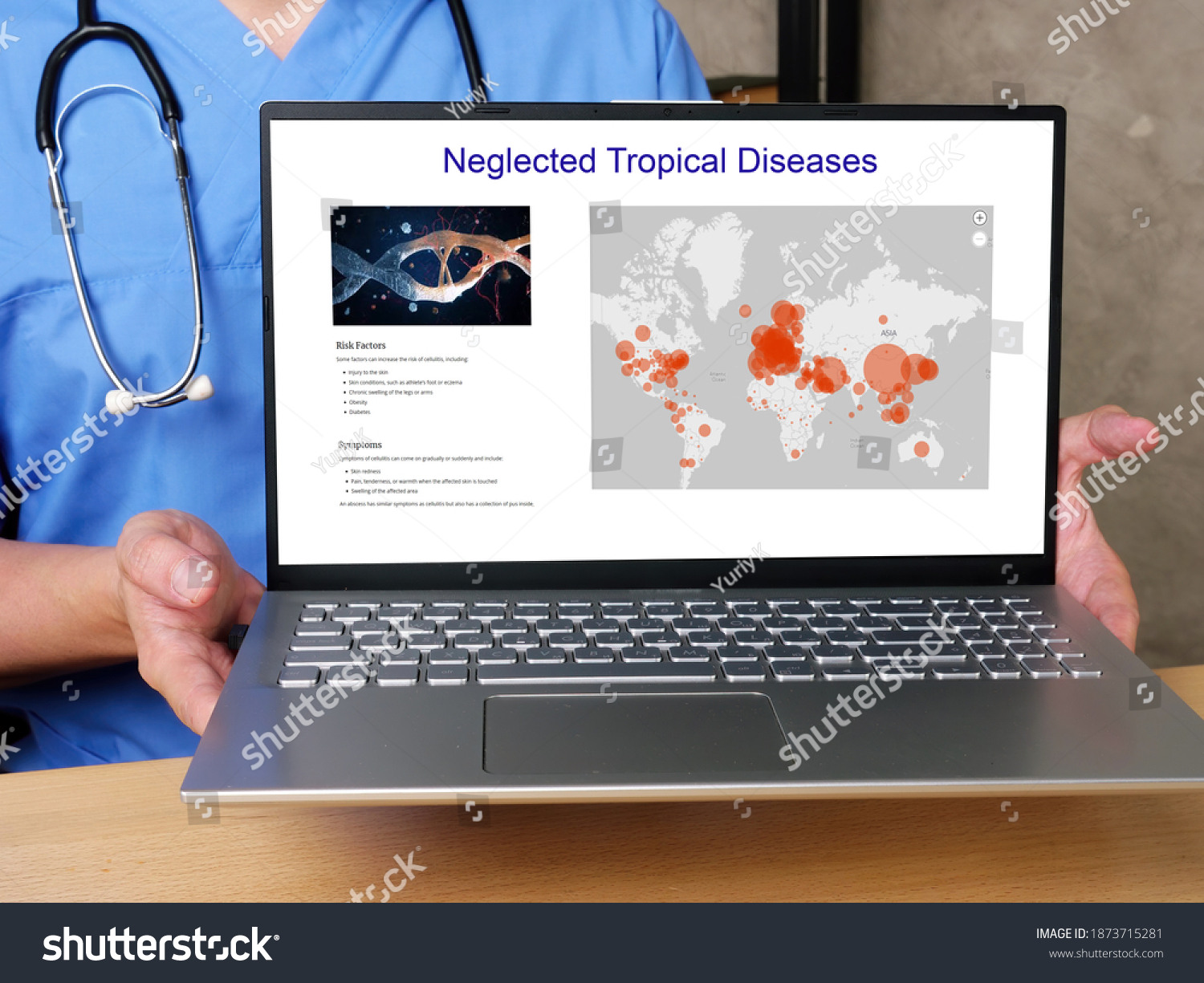 Health care concept meaning Neglected Tropical Diseases  with sign on the piece of paper.
 #1873715281