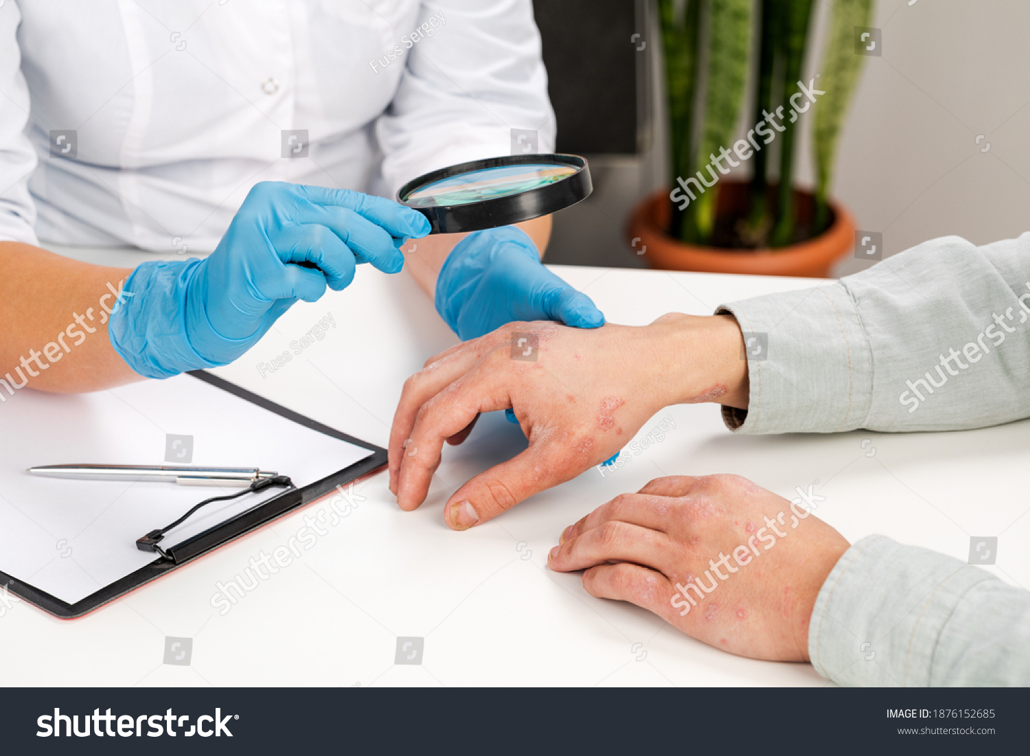 A dermatologist wearing gloves examines the skin of a sick patient. Examination and diagnosis of skin diseases-allergies, psoriasis, eczema, dermatitis. #1876152685