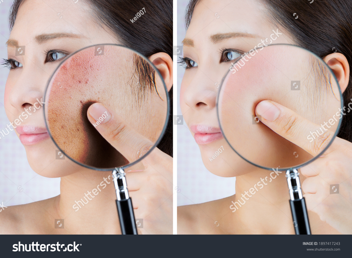 The texture of the skin of young women is magnified and compared with a magnifying glass. #1897417243