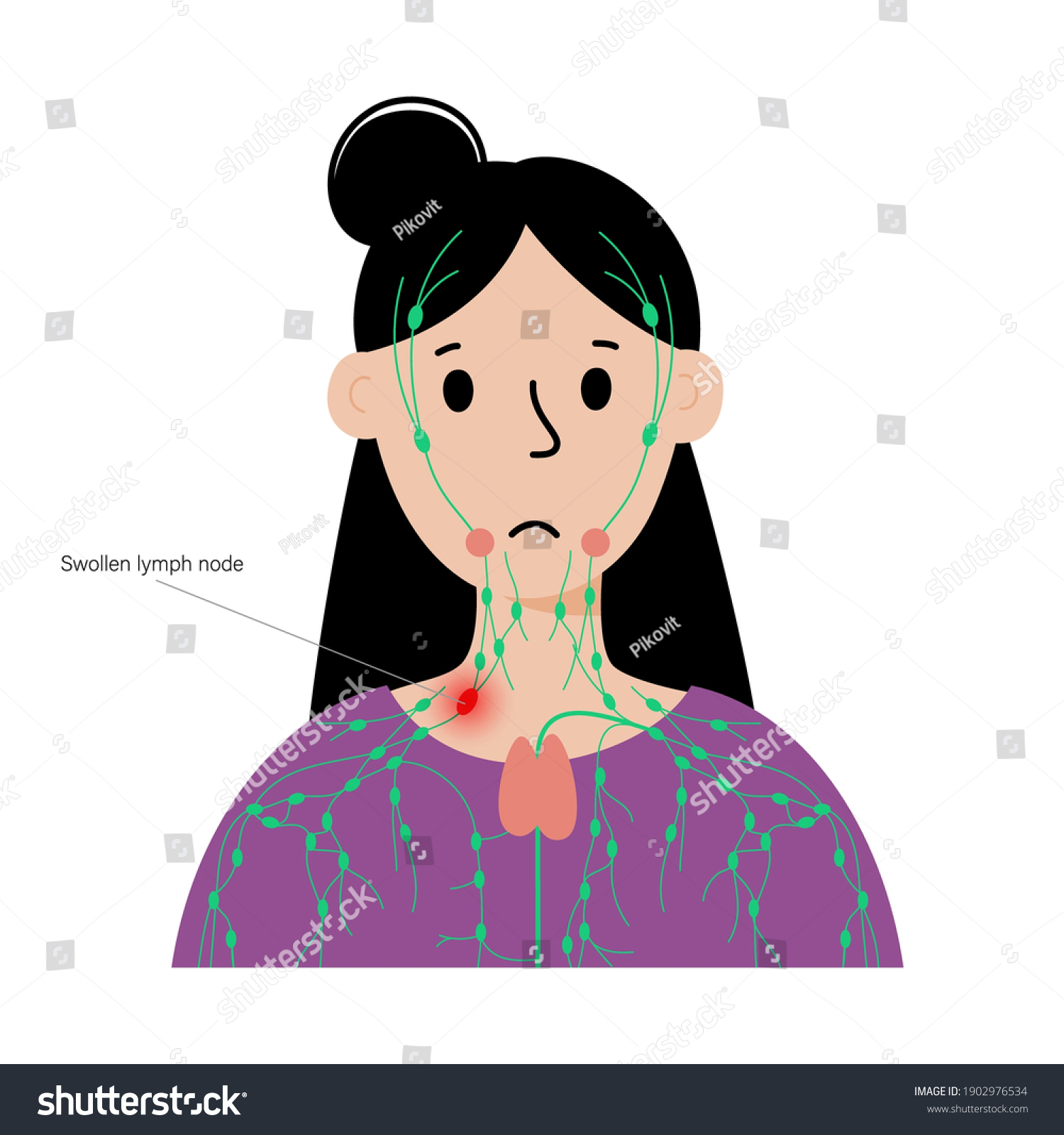 Lymph Node With Tumor In Woman Or Girl Royalty Free Stock Vector Avopix Com