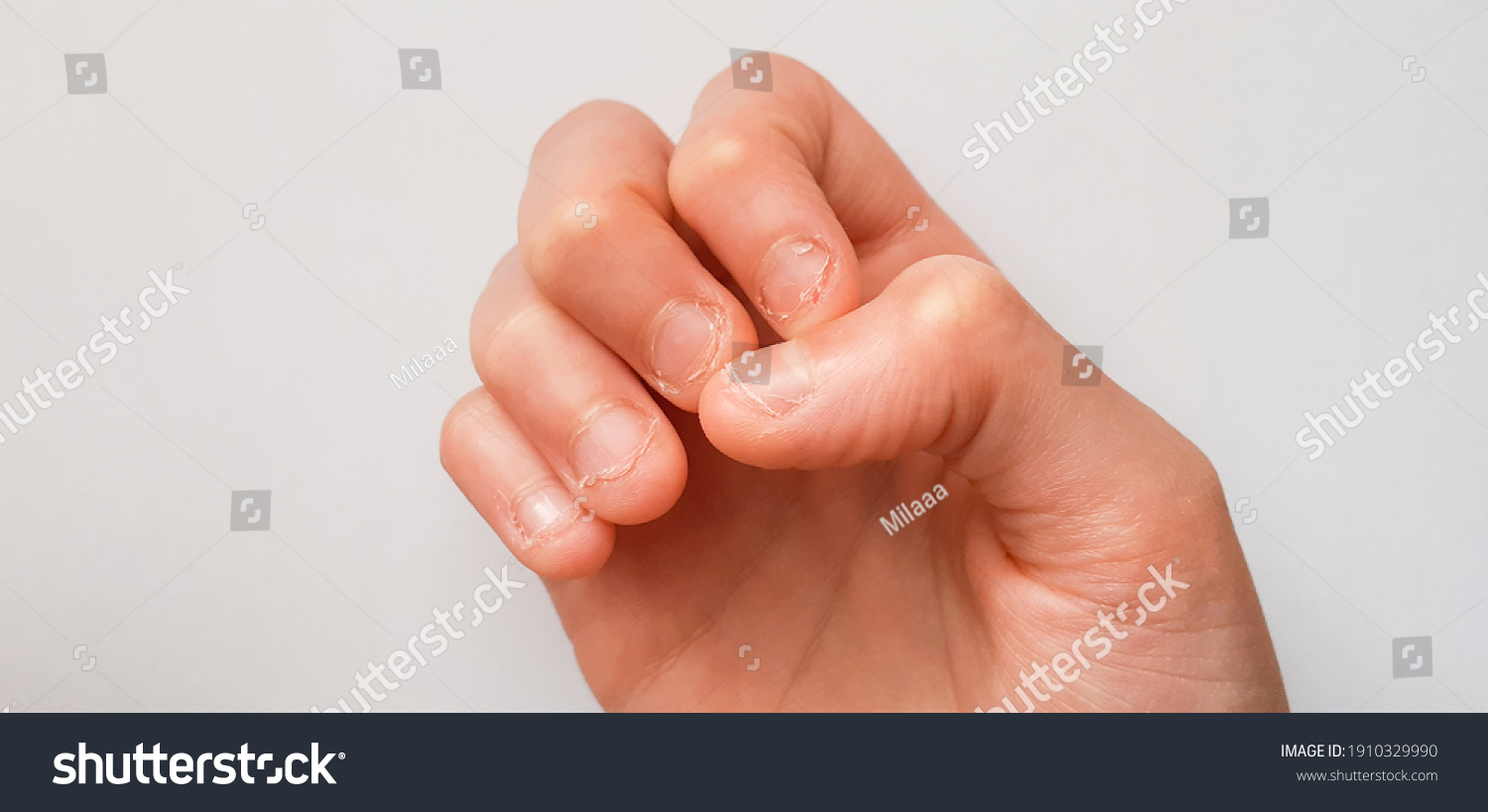 boys hand with chewed fingernails on white background - kids hand with short fingernails #1910329990