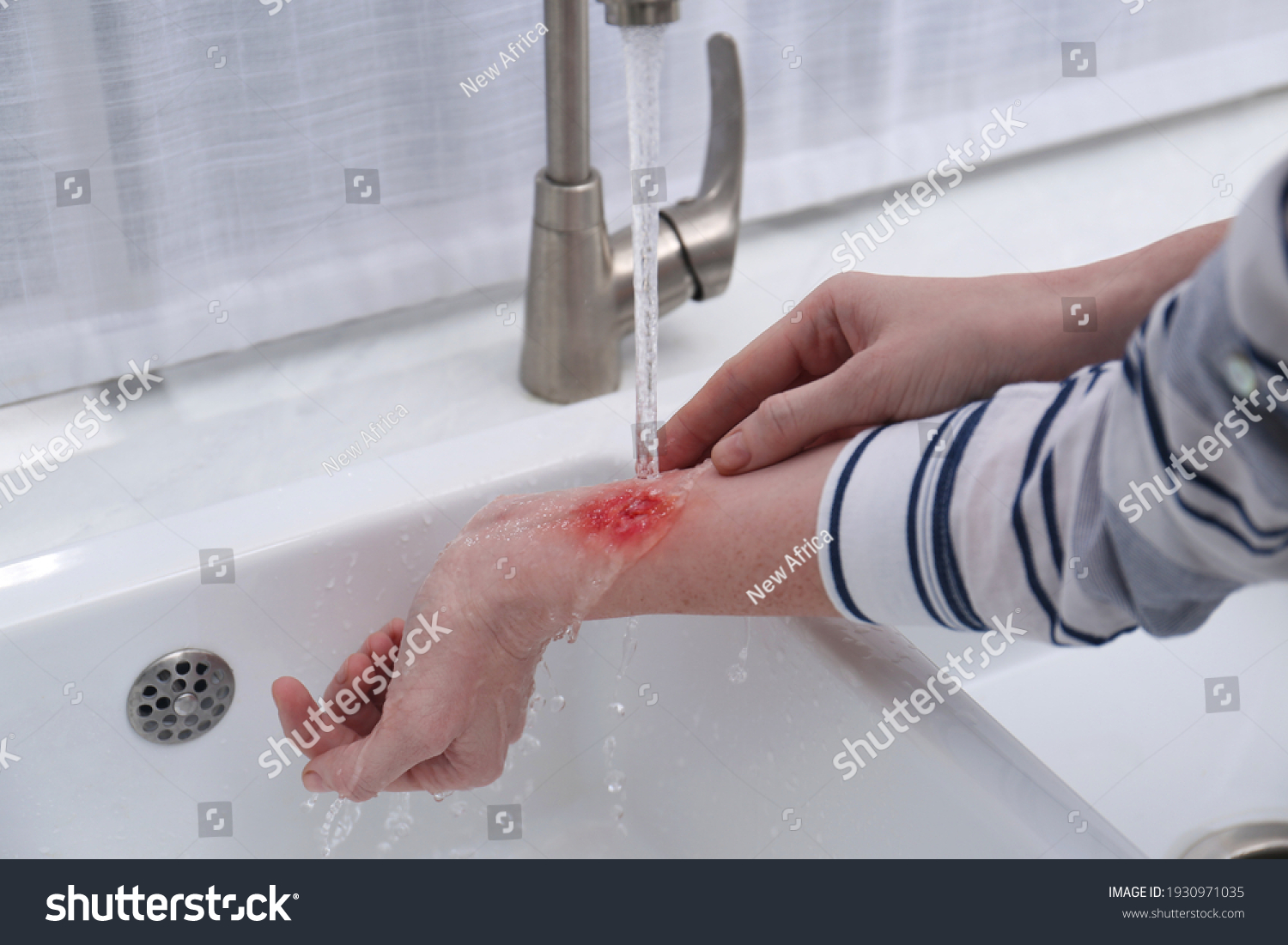 Woman holding forearm with burn under flowing water indoors, closeup #1930971035