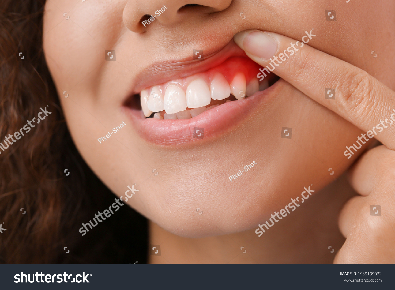 Woman with gum inflammation, closeup #1939199032