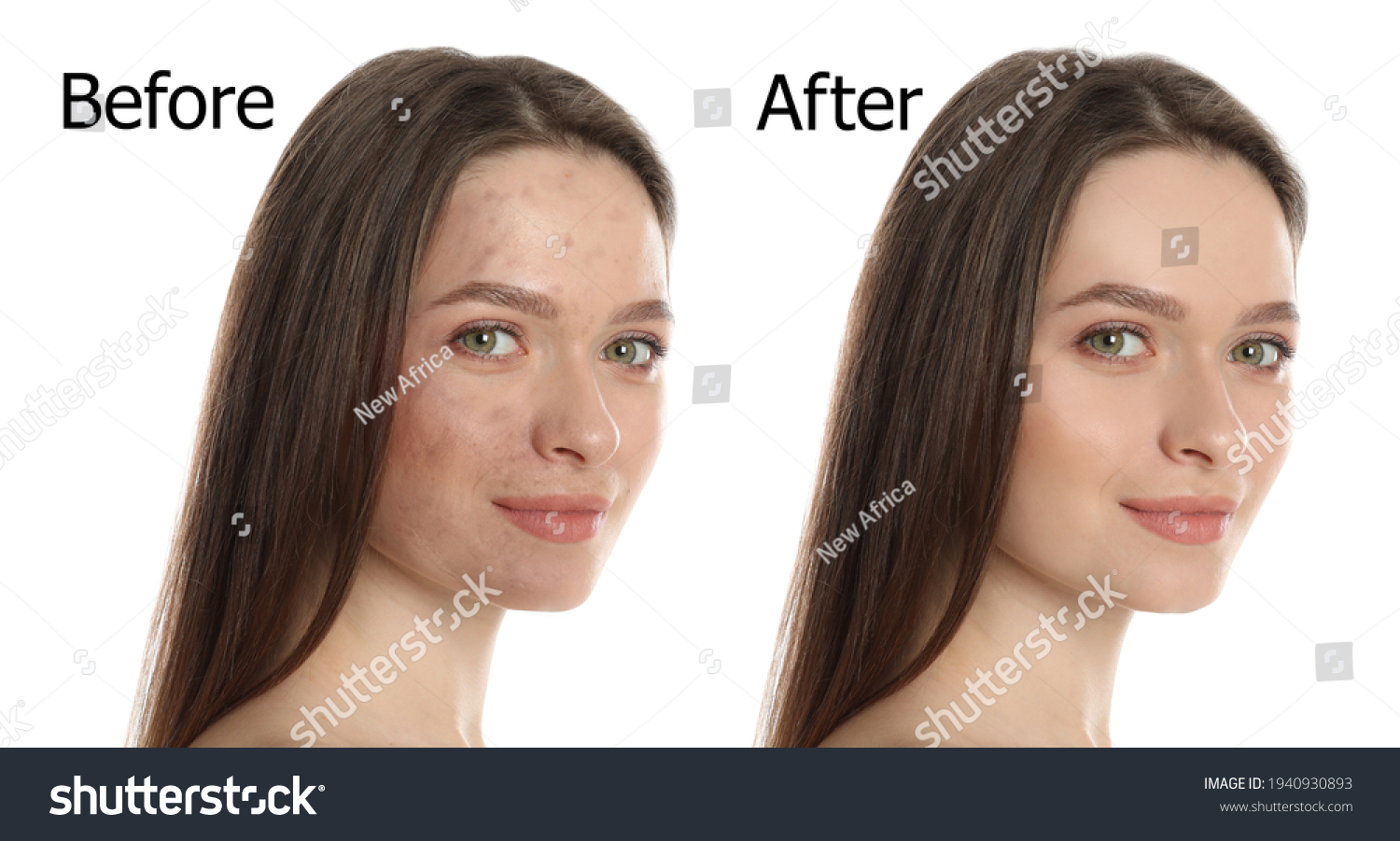 Young woman before and after cosmetic procedure on white background #1940930893