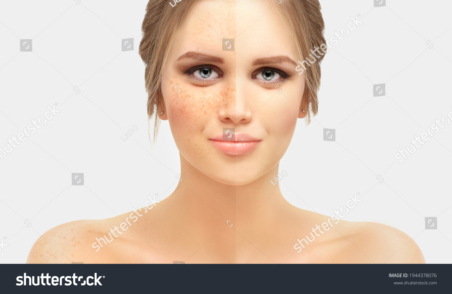 Freckles. Model's face divided in two parts - Royalty Free Stock Photo ...