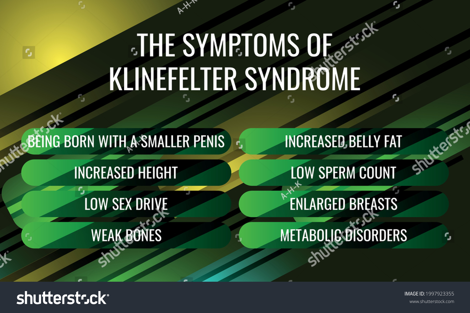 the symptoms of Klinefelter syndrome. Vector illustration for medical journal or brochure. #1997923355