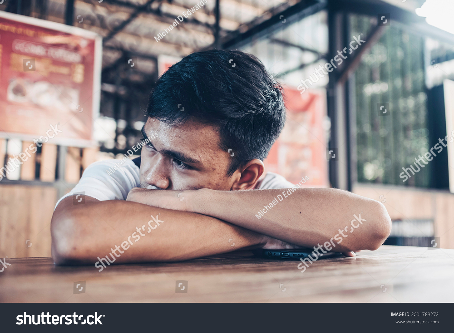 A depressed and lonely teen lying on the table at a outdoor food court. Low self esteem from facial acne. #2001783272