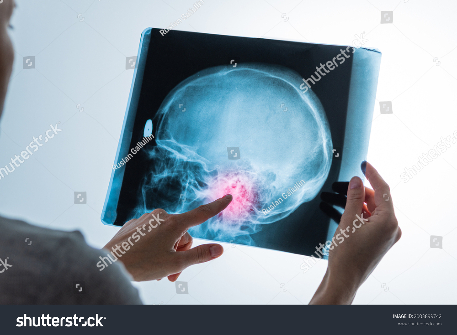 X-ray analysis of head skull image with red pain point in hands of specialist, closeup #2003899742