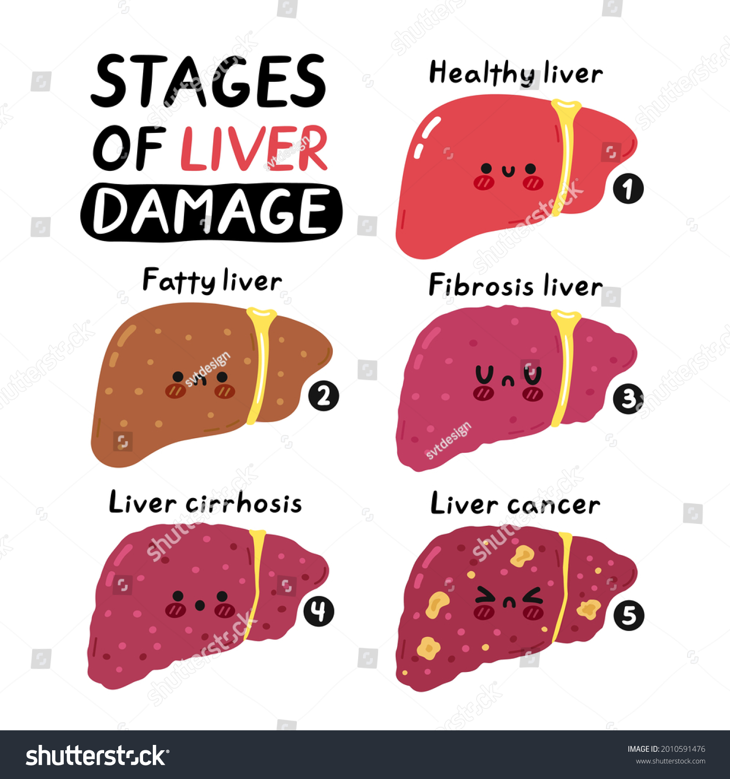 Stages of liver damage infographic. Vector hand - Royalty Free Stock ...