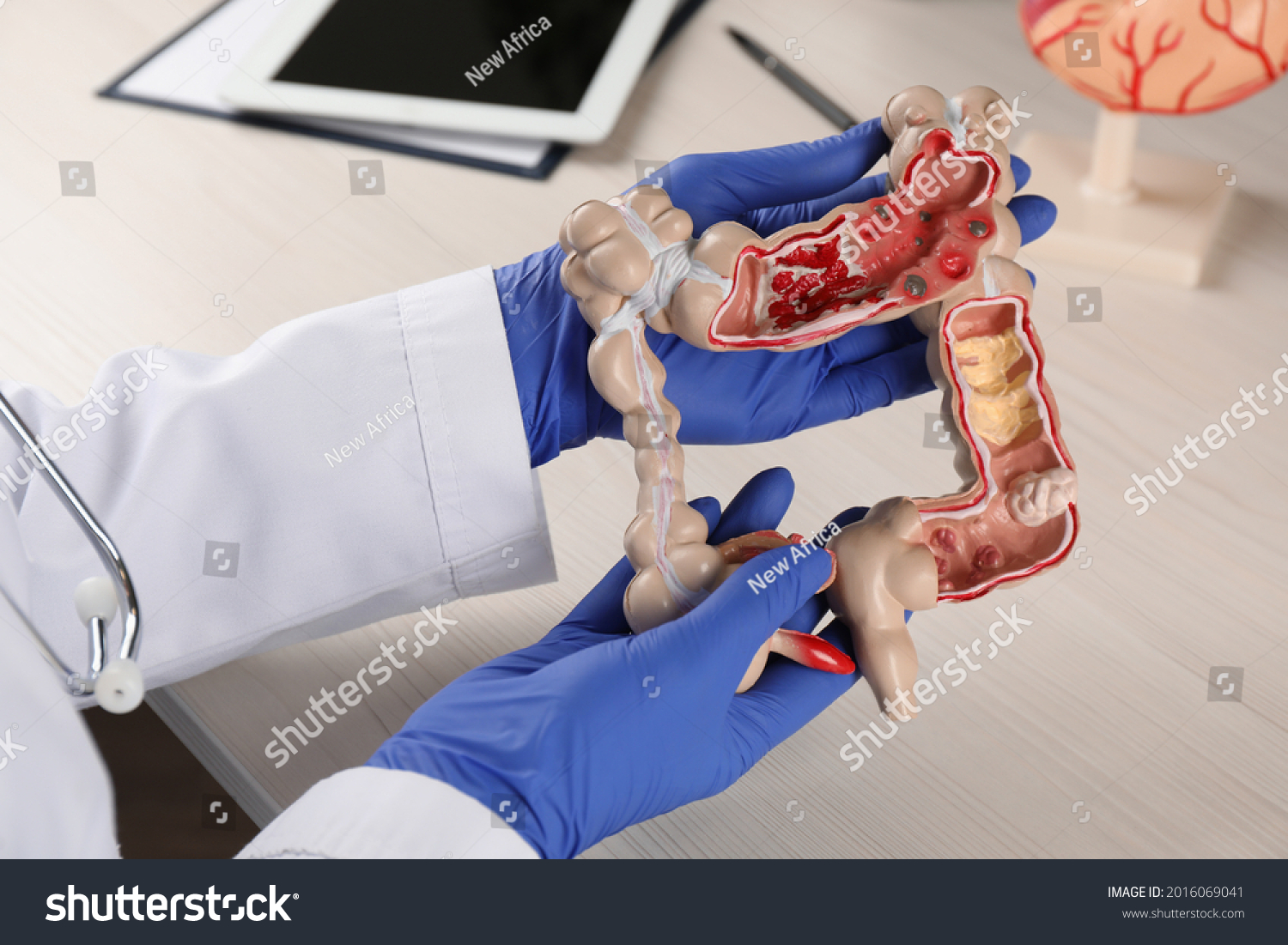 Gastroenterologist with human colon model at table, closeup #2016069041