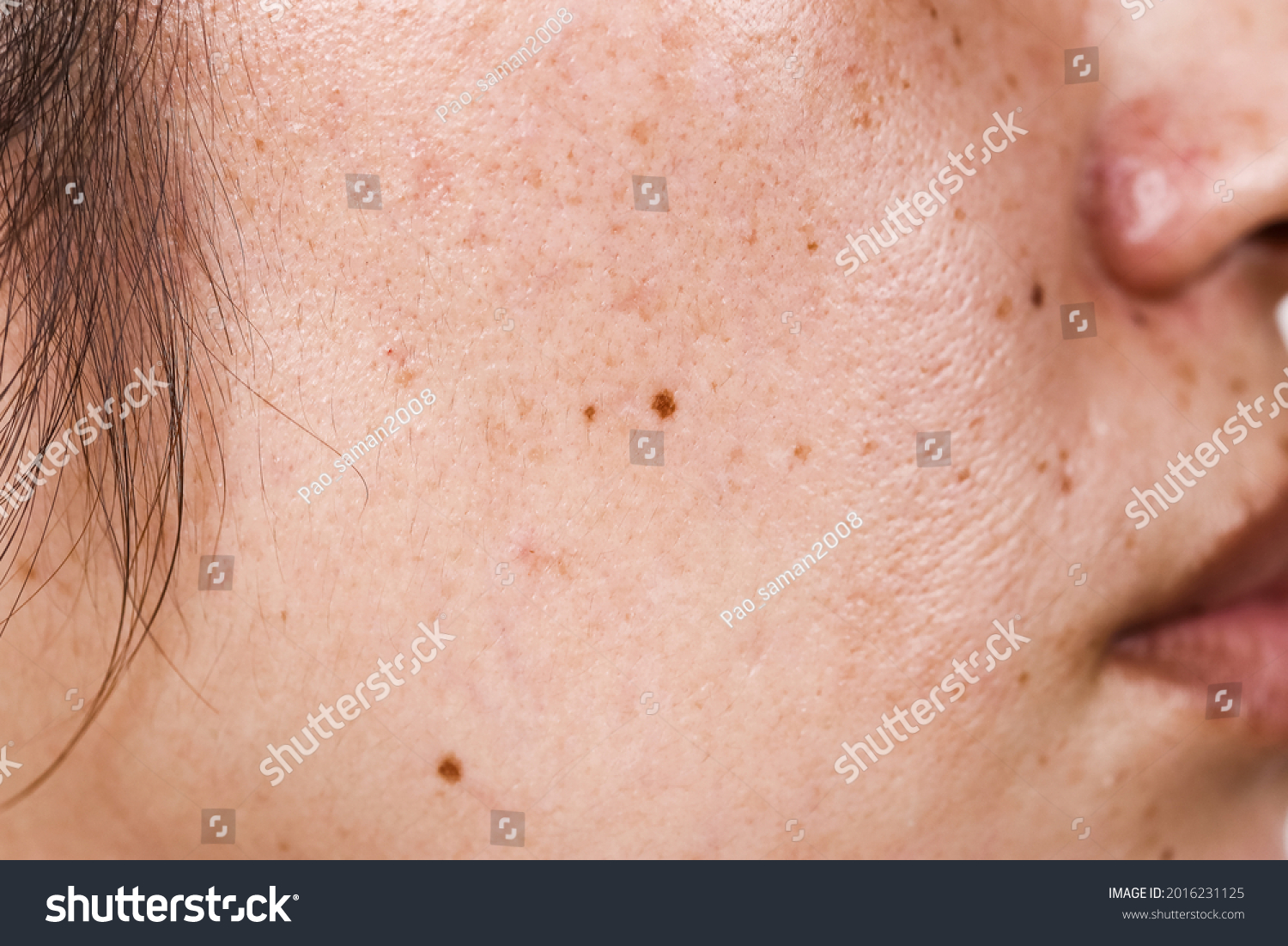 close-up of woman's face with large pores black dots and freckles on the surface of the face #2016231125