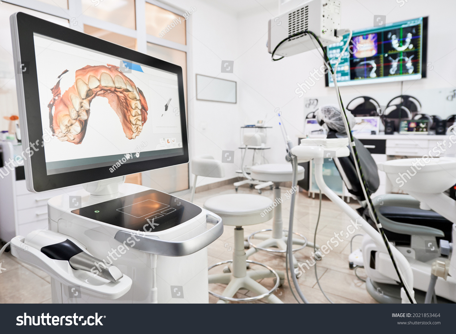 Interior of dental office with modern equipment and dental intraoral scanner with teeth on display, medical system for intraoral scanning. Concept of digital dentistry and dental scanning technology. #2021853464