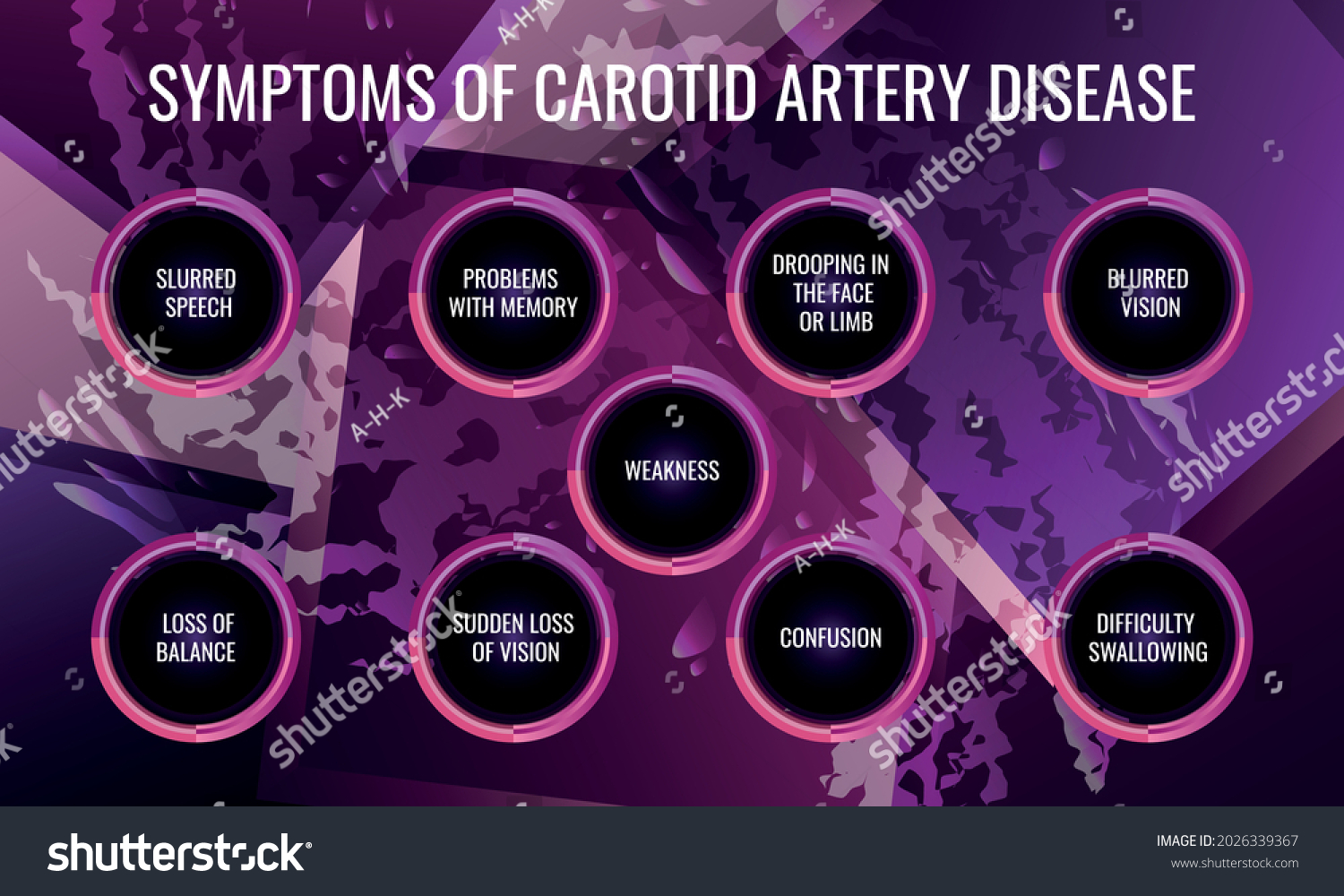 symptoms of Carotid artery disease. Vector illustration for medical journal or brochure. #2026339367