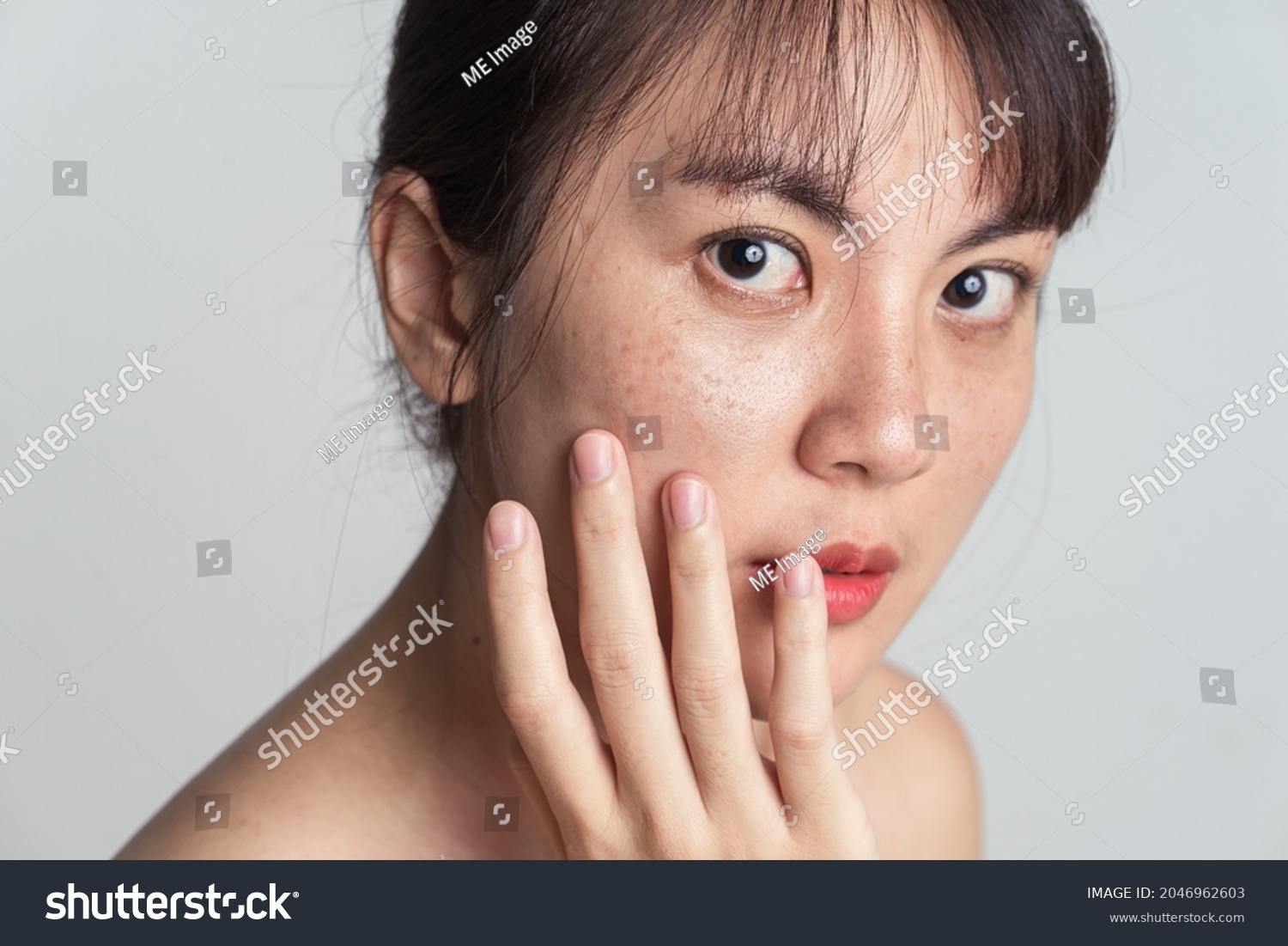 Young Asian woman worry with freckle on face and hand gently touching cheek applying skincare cosmetics treatment. #2046962603