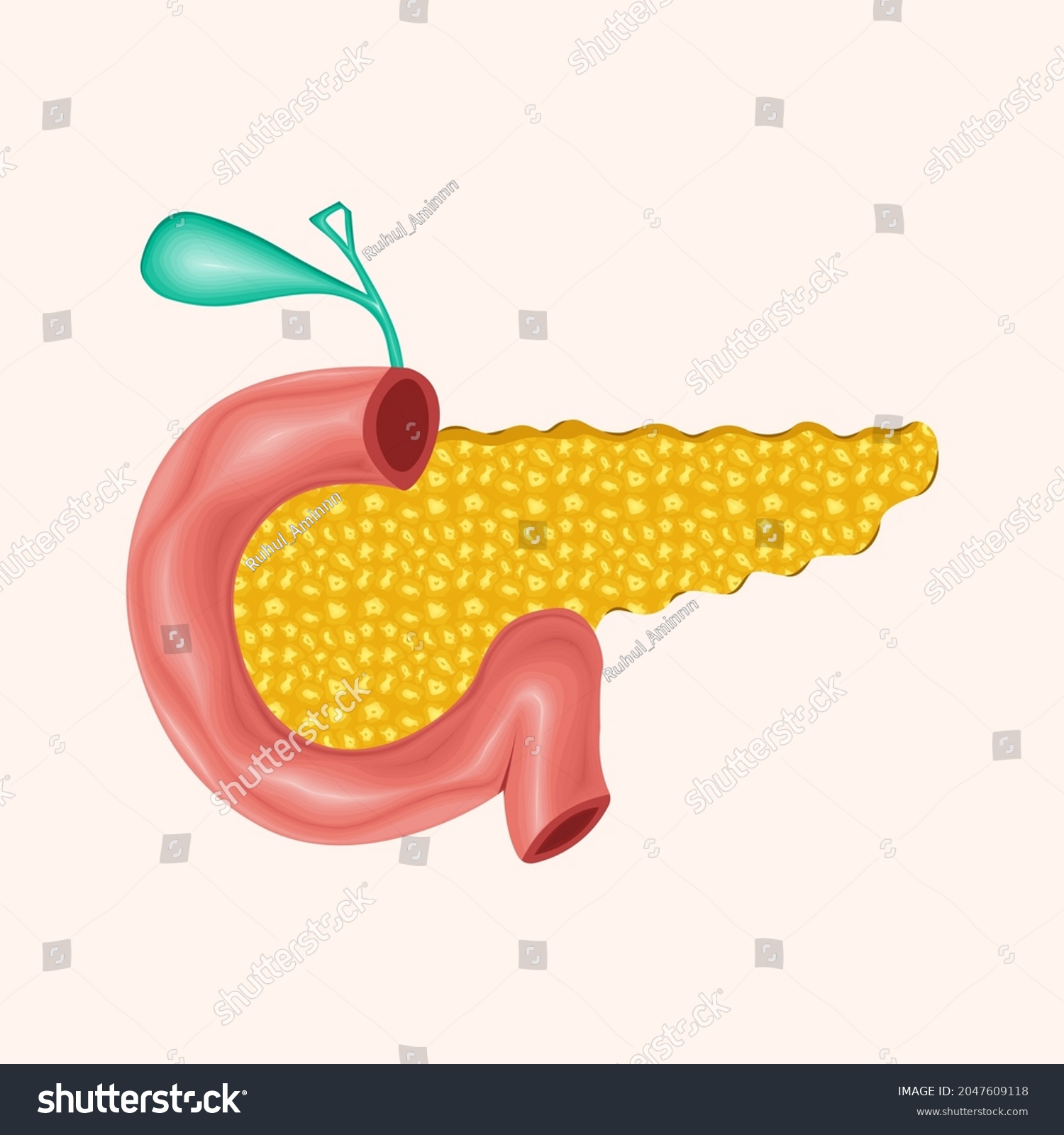 Pancreatitis Anatomy. pancreatic cancer. - Royalty Free Stock Vector ...