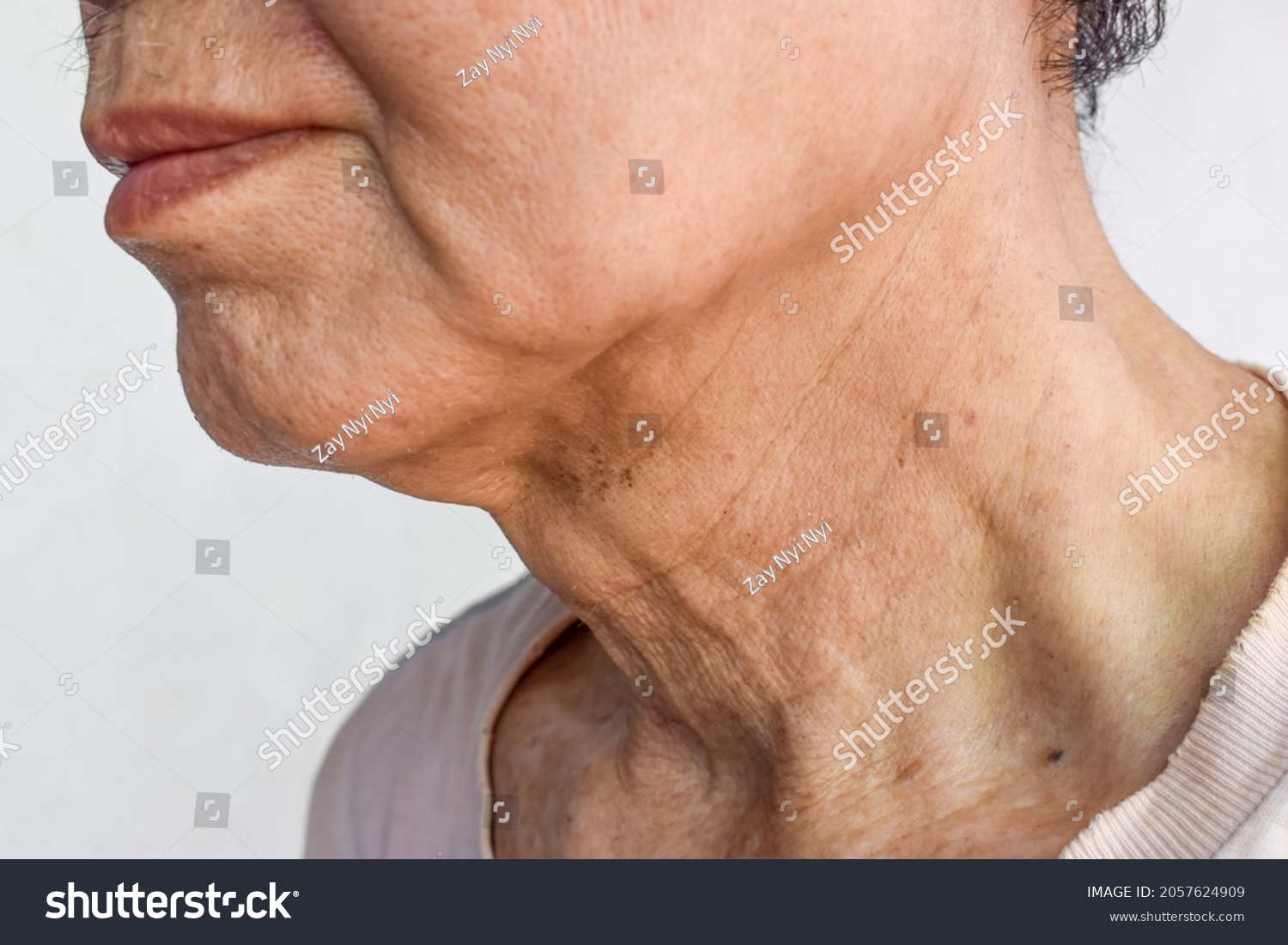 Aging skin folds or skin creases or wrinkles at neck of Southeast Asian, Chinese old man. #2057624909