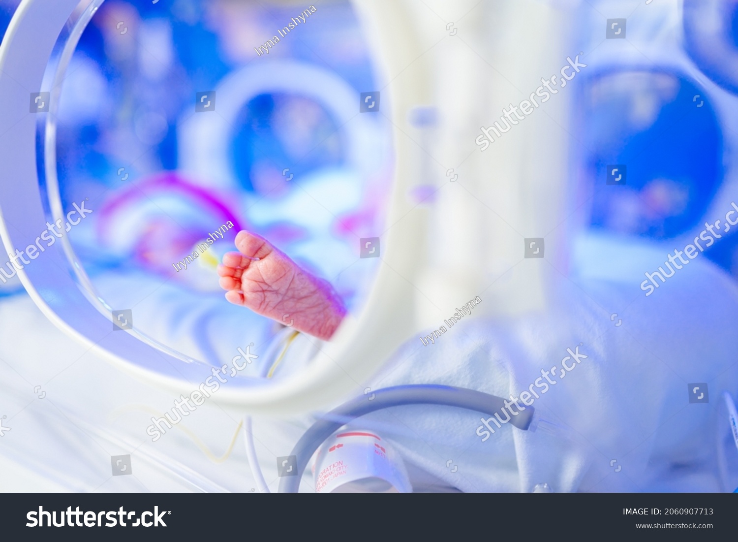 New born premature baby girl in intensive care unit in a medical incubator under ultraviolet lamp. Phototherapy treatment to reduce bilirubin levels in newborn jaundice. Neonatal icu. #2060907713