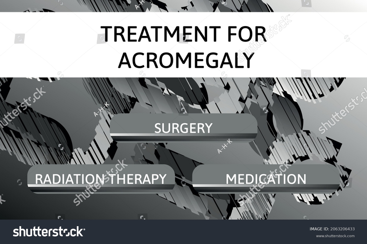 Treatment For Acromegaly Vector Illustration Royalty Free Stock 