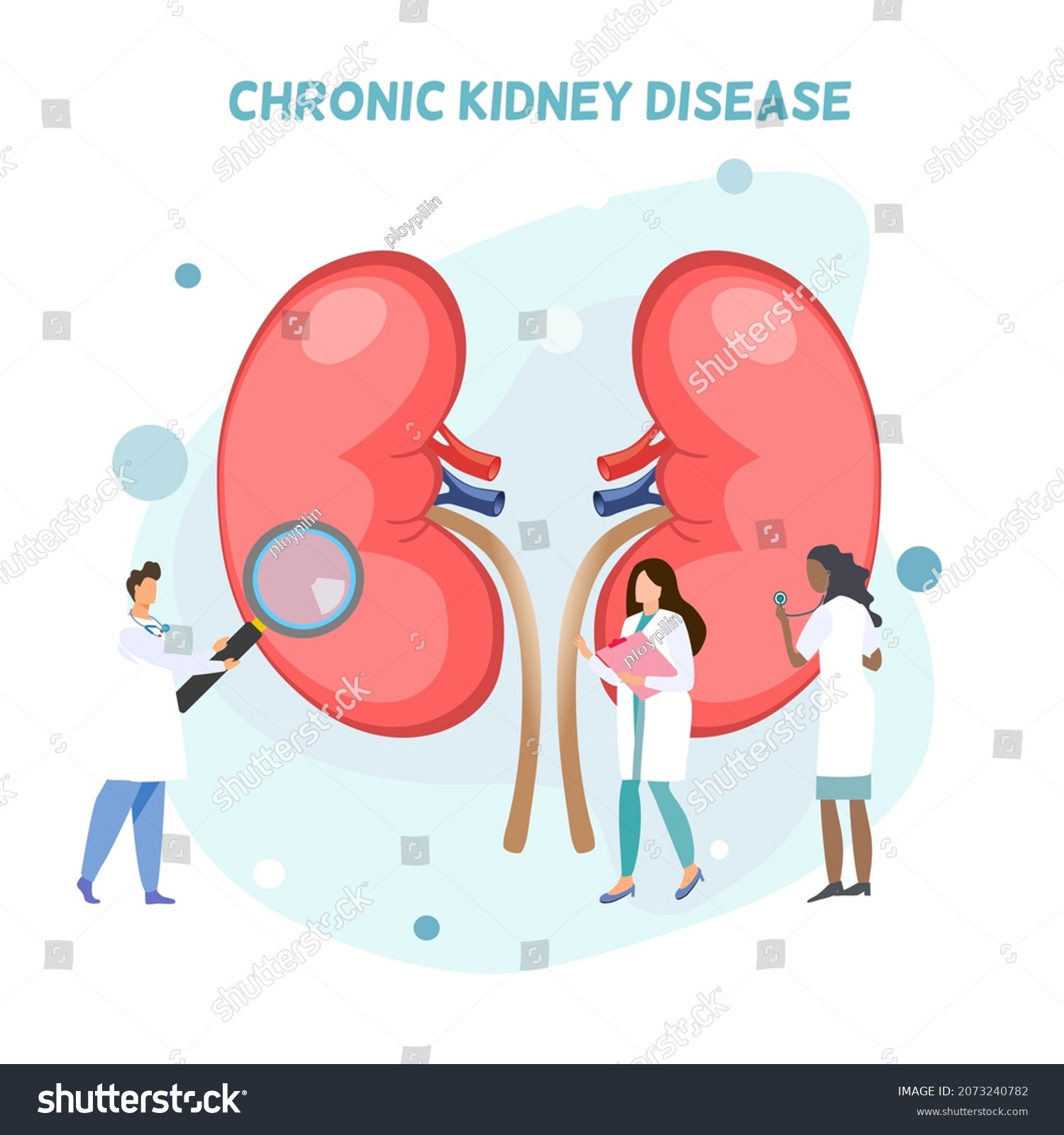 Group of doctors doing activities around human kidneys, diagnosis o about kidney disease, chronic kidney disease, long term illness, a lady doctor using stethoscope, a doctor holding magnifying glass #2073240782