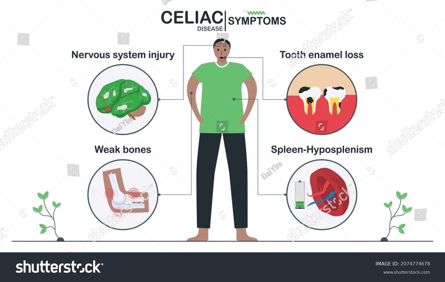 Inside, Celiac disease symptoms include nervous - Royalty Free Stock ...