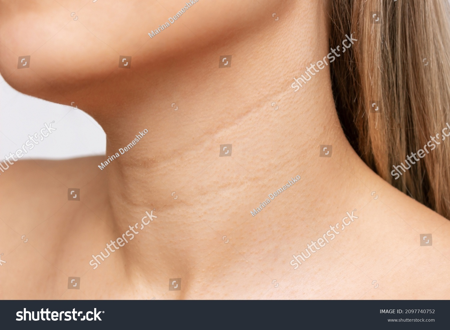 Сlose-up of a young blonde woman's neck  on a white background. Lines on the neck. Wrinkles, age-related changes, rings of Venus, goosebumps. Skin care #2097740752