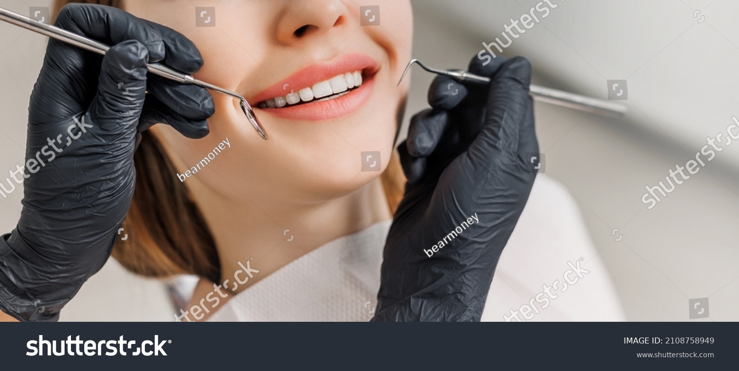 Banner for dental theme. Close-up of female smile with white teeth during medical examination. Concept of tooth whitening, treatment, veneers, professional clinic. Photo with free copy space. #2108758949
