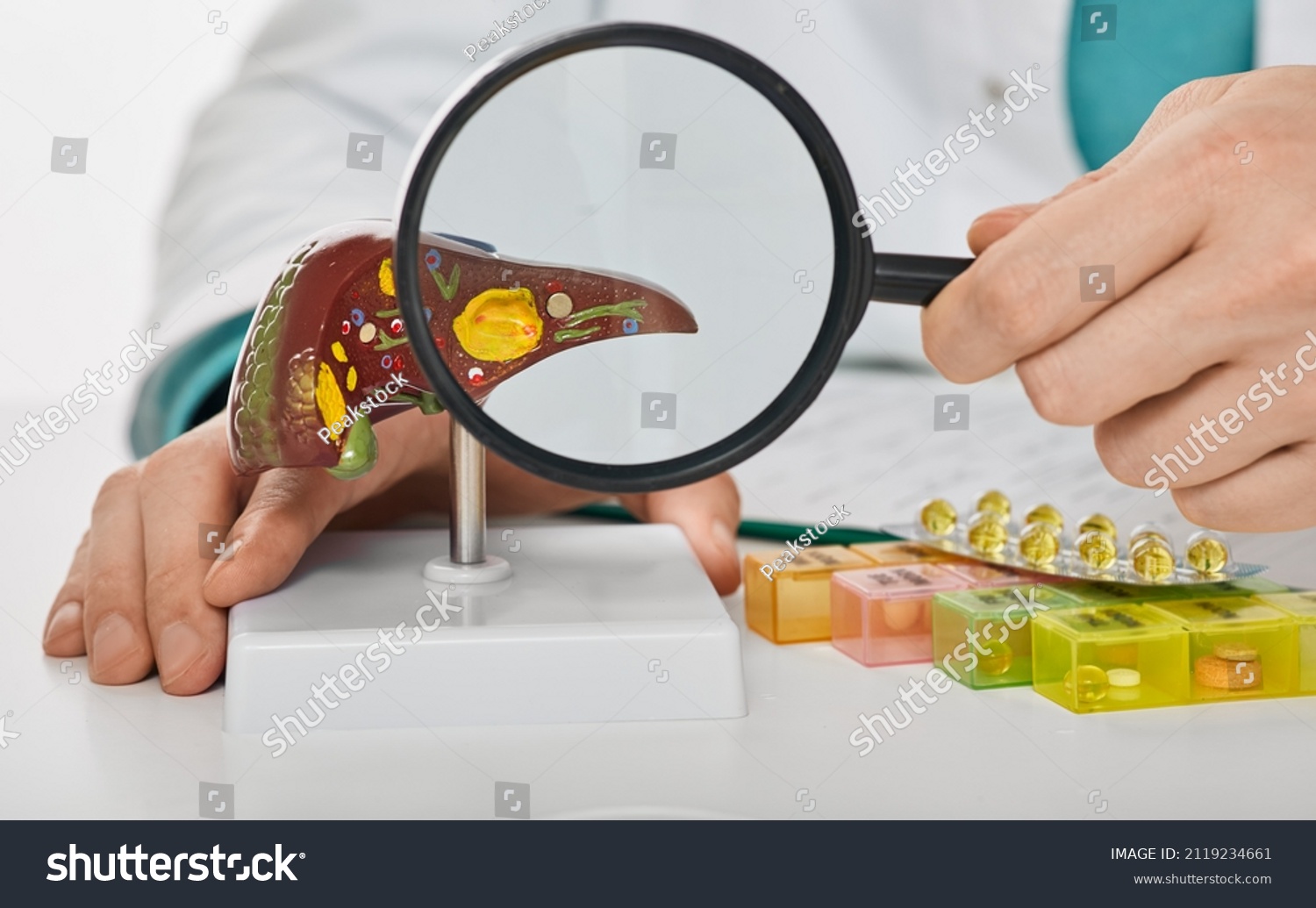 Human liver disease, diagnosis and liver treatment. Doctor showing liver anatomical model for treatment hepatitis, cirrhosis and cancer #2119234661