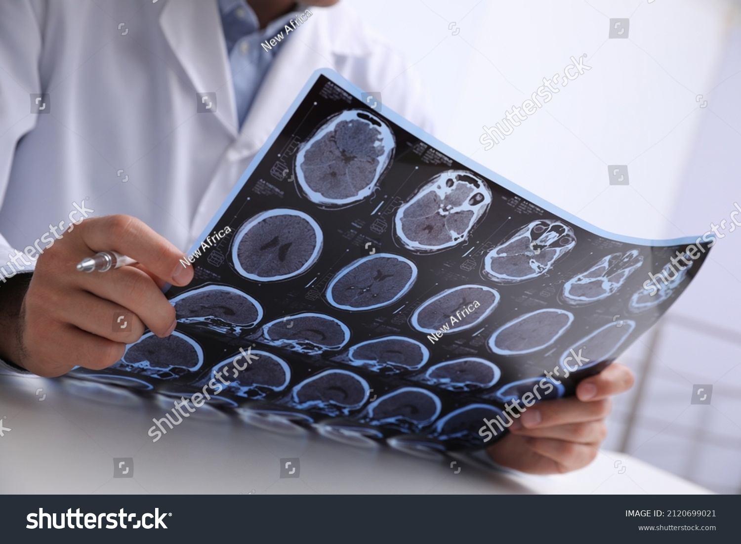 Doctor examining MRI images of patient with multiple sclerosis at table in clinic, closeup #2120699021