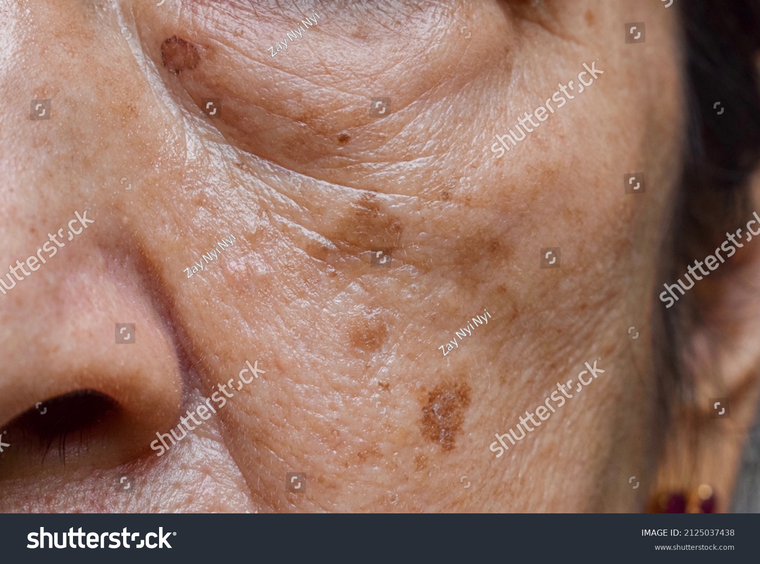 Small brown patches called age spots on face of Asian elder woman. They are also called liver spots, senile lentigo, or sun spots. Closeup view. #2125037438