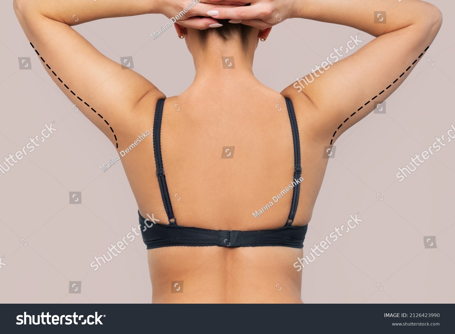 Cropped shot of a young woman with excess fat on her upper arm with marks for liposuction or plastic surgery isolated on a beige background. Loose and saggy muscles. Overweight. Beauty surgery concep #2126423990