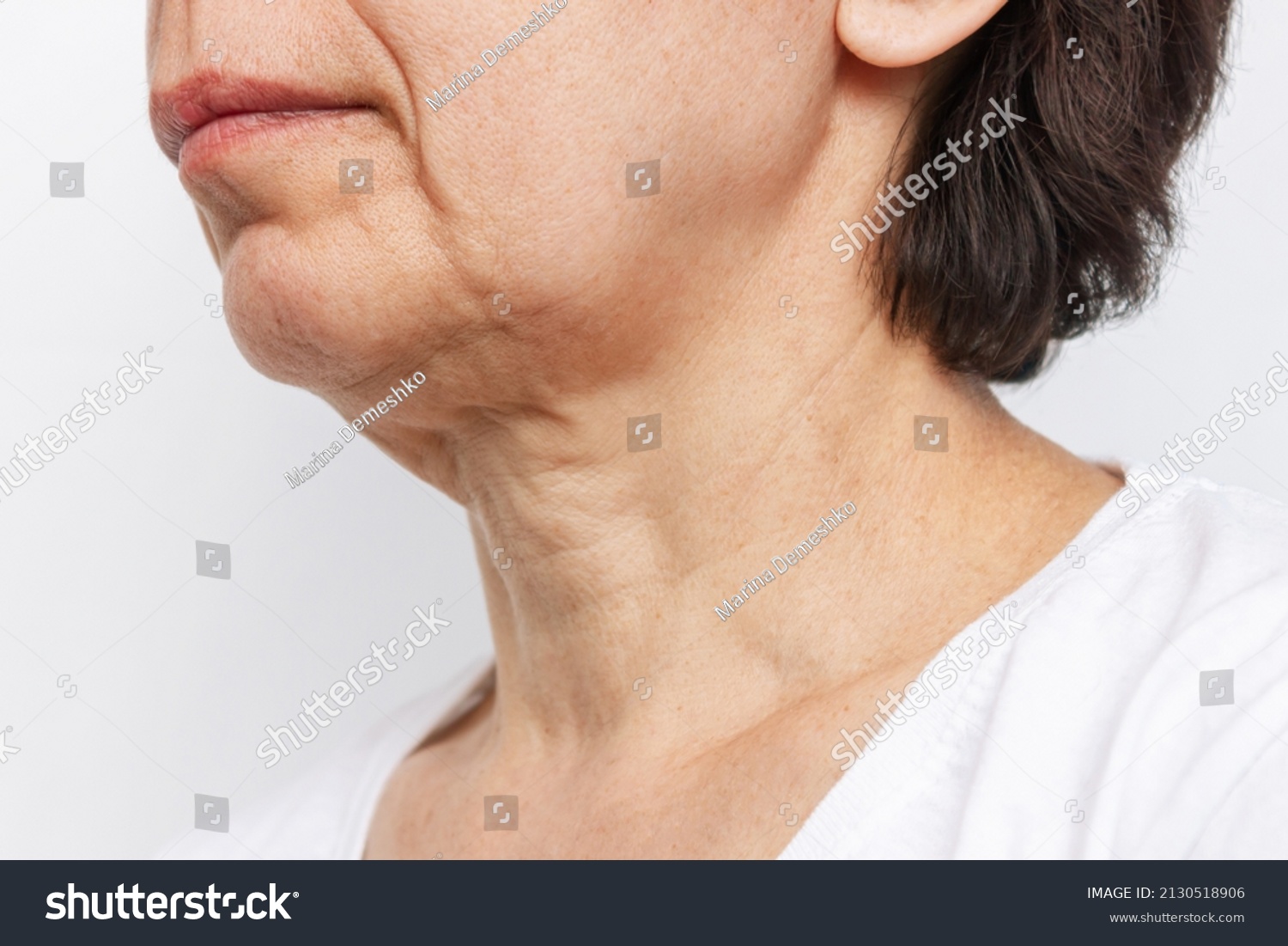 The lower part of elderly woman's face and neck with signs of skin aging isolated on a white background. Age-related changes, flabby sagging facial skin. Cosmetology and beauty concept #2130518906