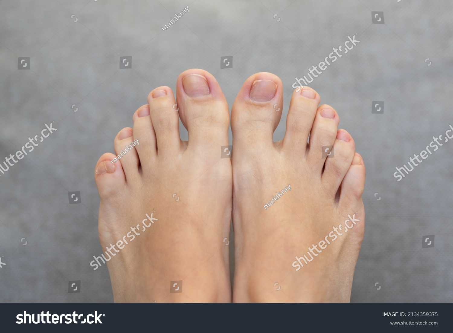 Closeup of female feet and toes on white background. Healthy feet concept #2134359375