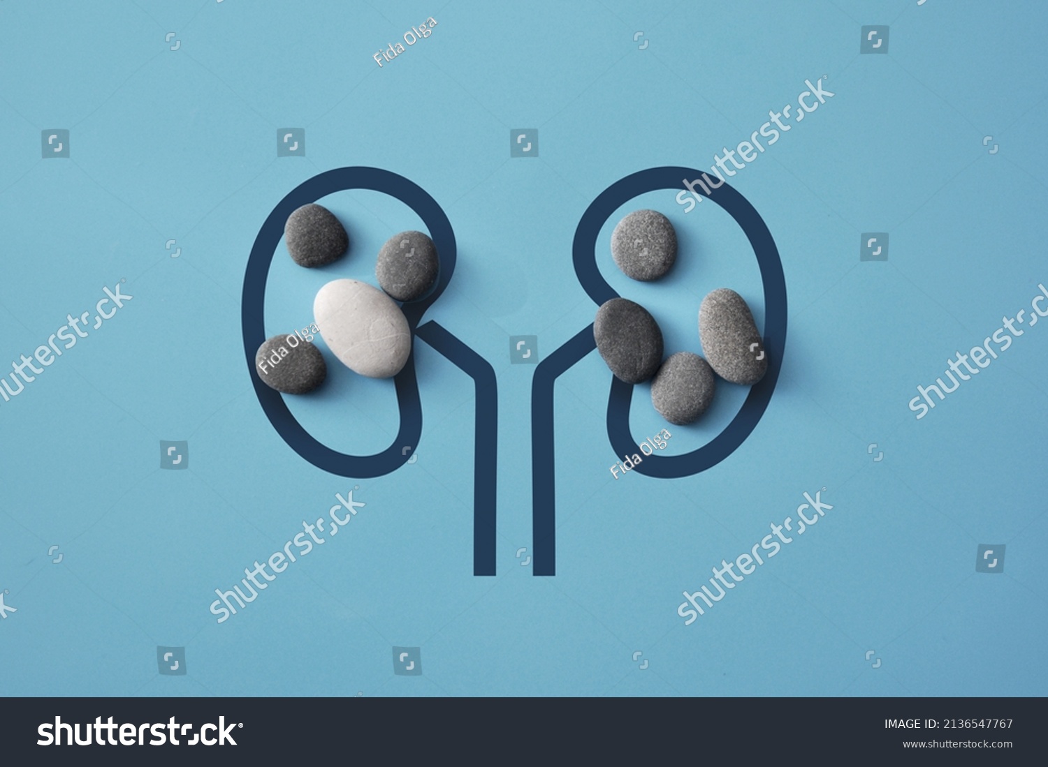 Stones on the silhouette of the kidneys. A symbol of kidney disease. Kidney stones #2136547767