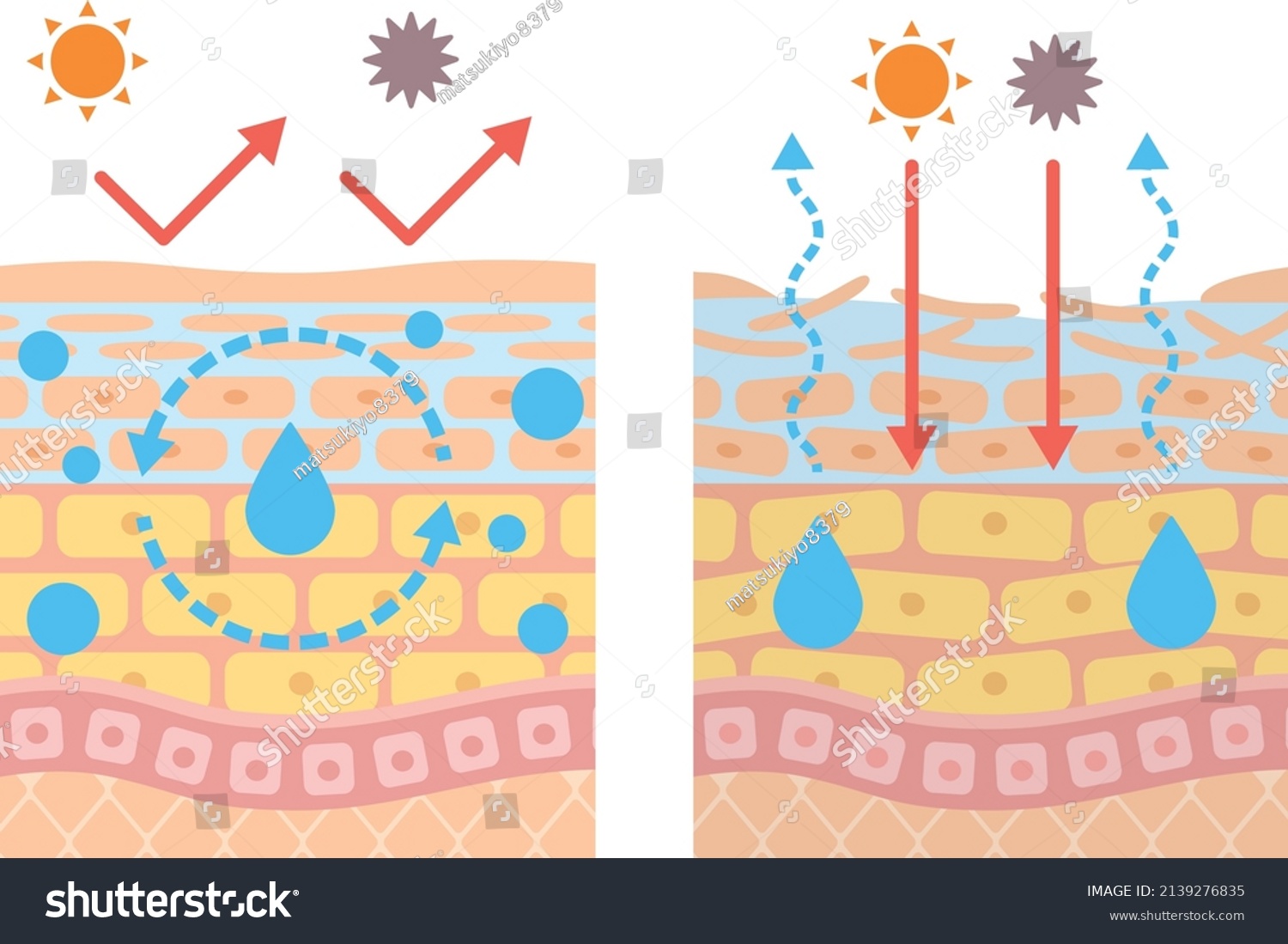 Structural diagram of the skin Dry skin Royalty Free Stock