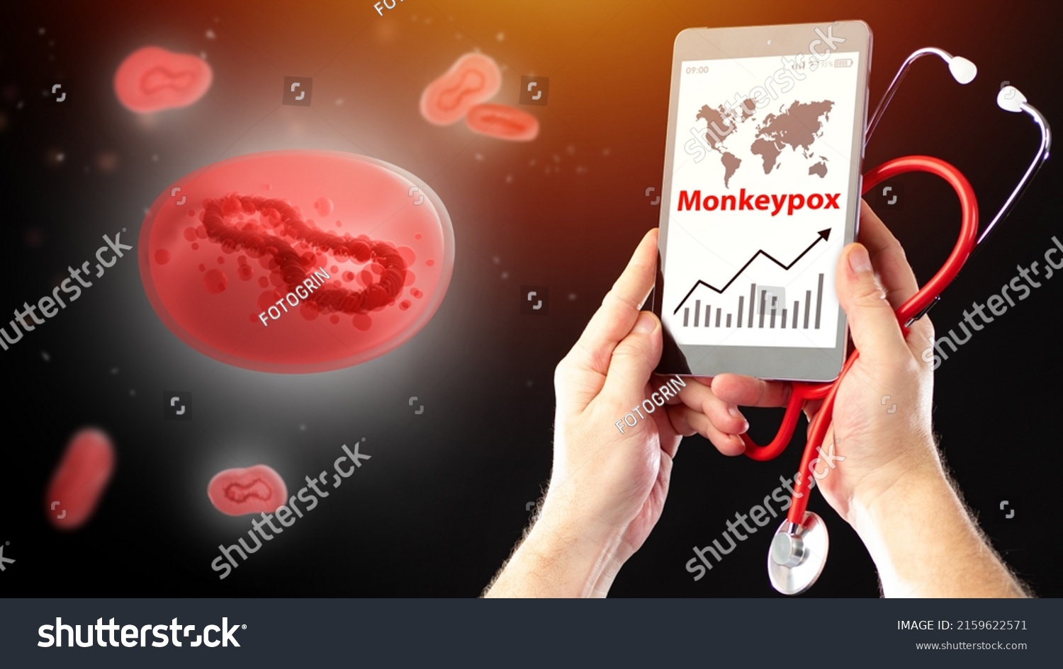 Monkeypox virus strain. Graph growth monkeypox infections in phone. Doctor hands with stethoscope on dark. Molecule is infected with fever. Monkeypox epidemic. Infectious virus outbreak.  #2159622571