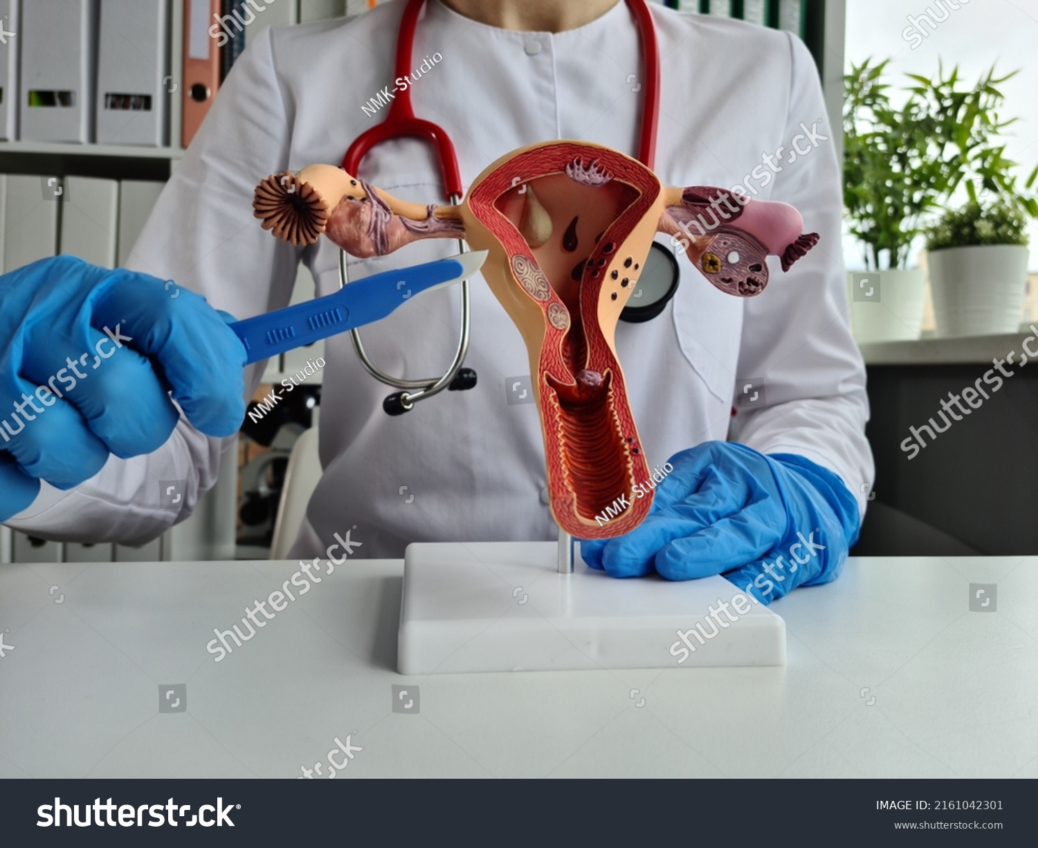 Hand of gynecologist doctor in glove holds out scalpel to female reproductive system. Surgery to remove the uterus #2161042301