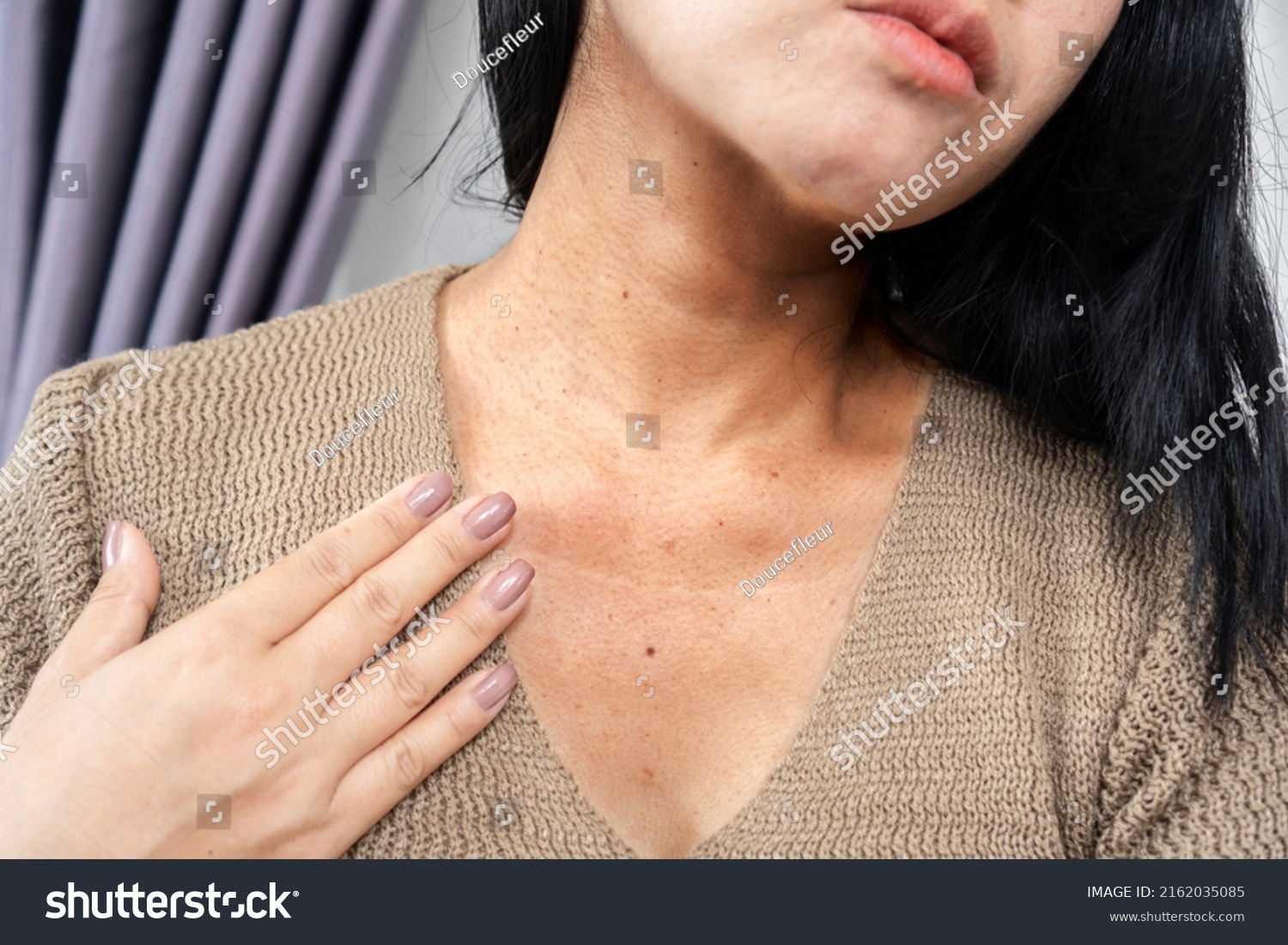 closeup woman having a problem with neck wrinkles, dark skin, aging process concept   #2162035085