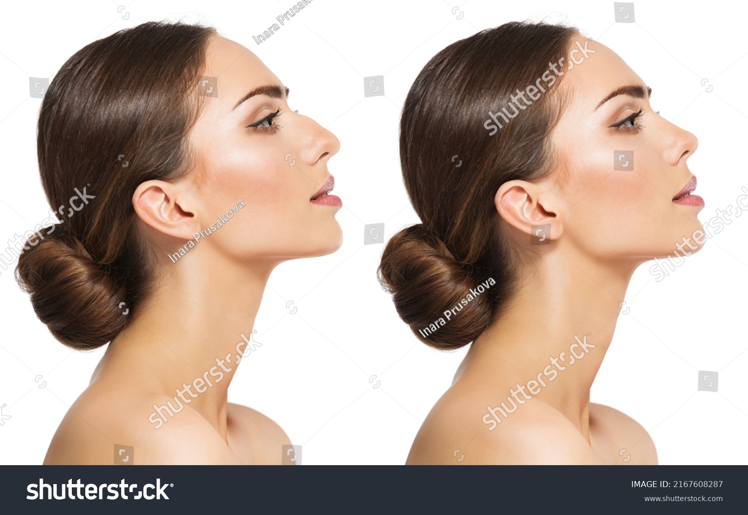 Woman Rhinoplasty. Women Nose Shape Before and After Plastic Surgery. Beauty Model Profile Side View over isolated White background #2167608287